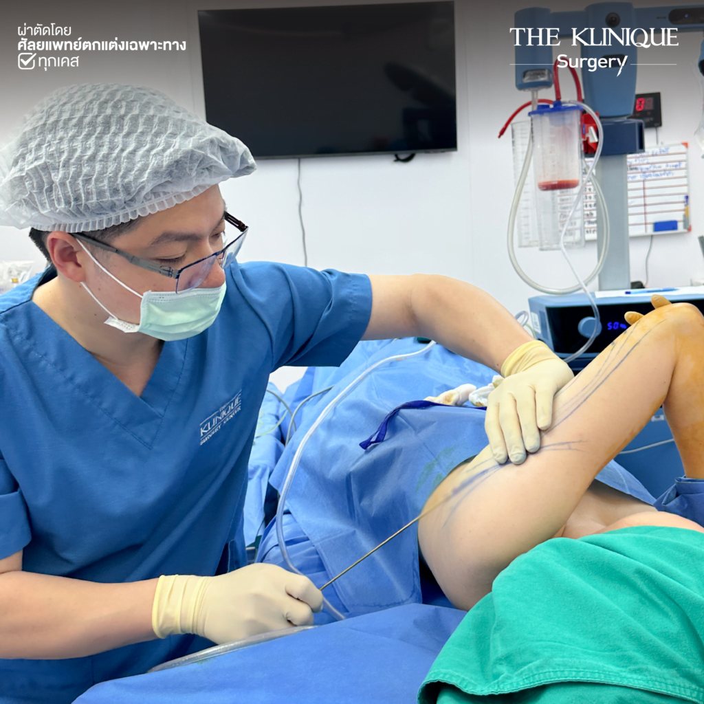 Liposuction, Sculpting,Xshape,Lipo, ศัลยกรรมดูดไขมัน, ดูดไขมัน,คลินิกดูดไขมัน,ดูดไขมันเฉพาะส่วน,ดูดไขมันเหนียง,ดูดไขมันหน้าท้อง,ดูดไขมันรีวิว, รีวิวดูดไขมัน, รีวิวดูดไขมันหน้าท้อง,ดูดไขมันต้นแขน, ดูดไขมันต้นขา,ดูดไขมันน่อง, ลดความอ้วน, ดูดไขมันที่ไหนดี, ดูดไขมันราคา, ดูดไขมันทั้งตัว