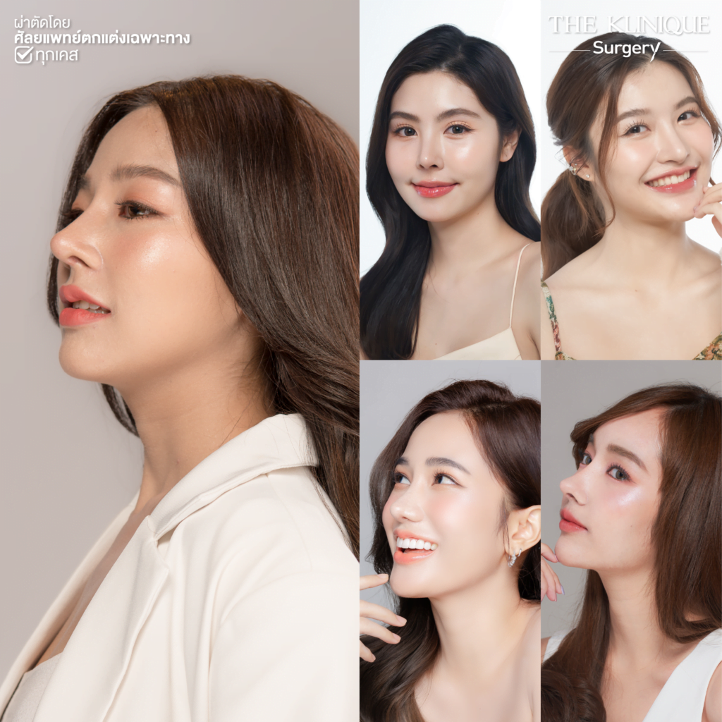 ทรงจมูก, ทรงจมูกสวย, ทรงจมูกเกาหลี, ทรงจมูกธรรมชาติ, ทรงจมูกสันสโลปปลายพุ่ง, ศัลยกรรมจมูก, ศัลยกรรมจมูก รีวิว, เสริมจมูก, เสริมจมูกที่ไหนดี, เสริมจมูกราคา, รีวิว เสริมจมูก, เสริมจมูก รีวิว, ทำจมูก, ทำจมูก รีวิว, เสริมจมูก Close, เสริมจมูก Semi Open, เสริมจมูก Open, เสริมจมูก โอเพ่น, ซิลิโคนจมูก, จมูก Open, รีวิวเสริมจมูกโอเพ่น, รีวิวเสริมจมูก Open