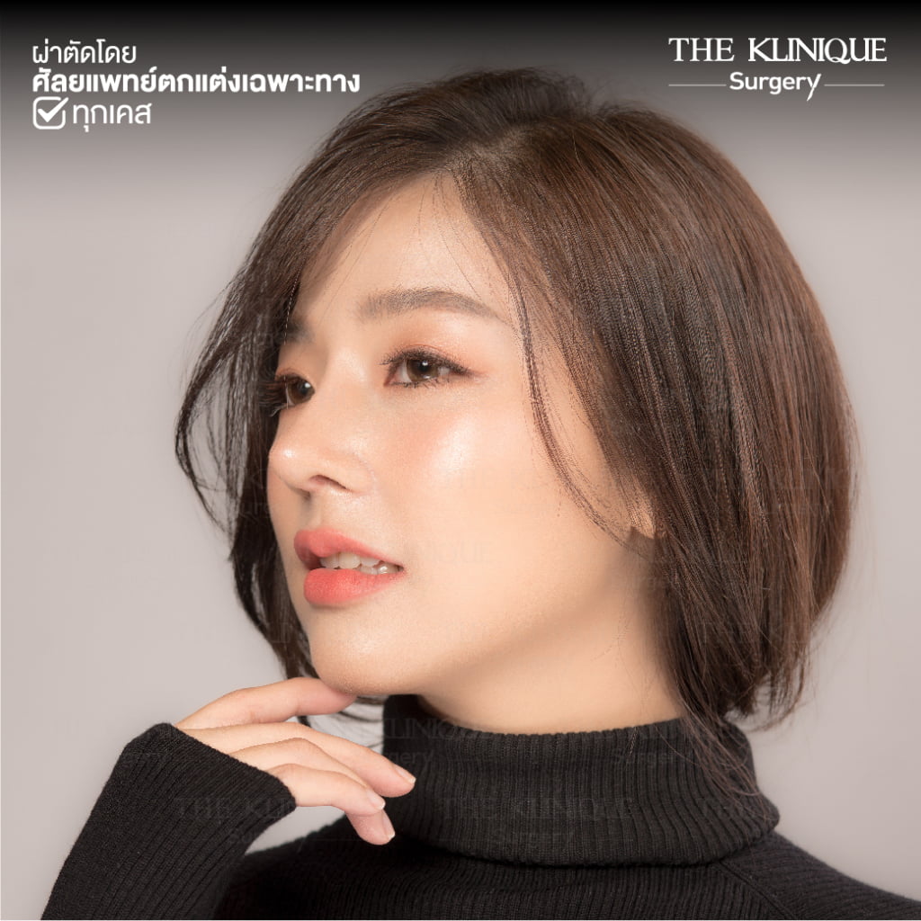 ทรงจมูก, ทรงจมูกสวย, ทรงจมูกเกาหลี, ทรงจมูกธรรมชาติ, ทรงจมูกสันสโลปปลายพุ่ง, ศัลยกรรมจมูก, เสริมจมูก, เสริมจมูกที่ไหนดี, เสริมจมูกราคา, รีวิว เสริมจมูก, ทำจมูก, ทำจมูก รีวิว,เสริมจมูก Semi Open, เสริมจมูก Open, เสริมจมูก โอเพ่น, ซิลิโคนจมูก, จมูกOpen, รีวิวเสริมจมูกโอเพ่น, รีวิวเสริมจมูก Open