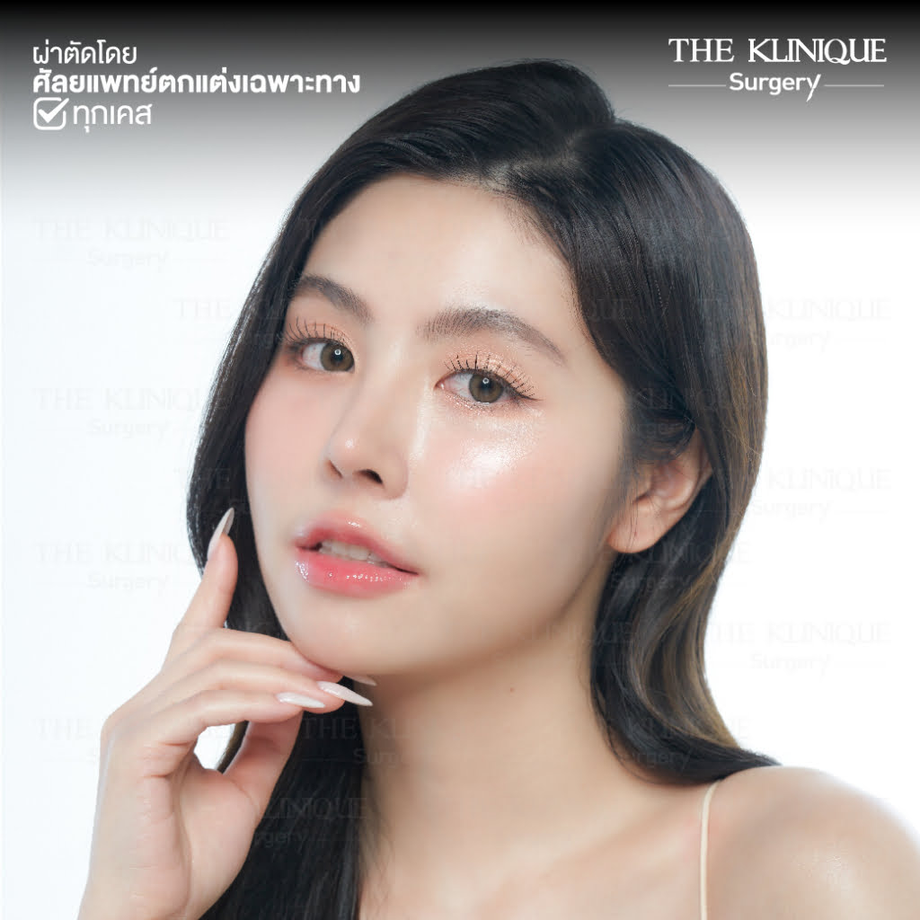 ทรงจมูก, ทรงจมูกสวย, ทรงจมูกเกาหลี, ทรงจมูกธรรมชาติ, ทรงจมูกสันสโลปปลายพุ่ง, ศัลยกรรมจมูก, เสริมจมูก, เสริมจมูกที่ไหนดี, เสริมจมูกราคา, รีวิว เสริมจมูก, ทำจมูก, ทำจมูก รีวิว,เสริมจมูก Semi Open, เสริมจมูก Open, เสริมจมูก โอเพ่น, ซิลิโคนจมูก, จมูกOpen, รีวิวเสริมจมูกโอเพ่น, รีวิวเสริมจมูก Open