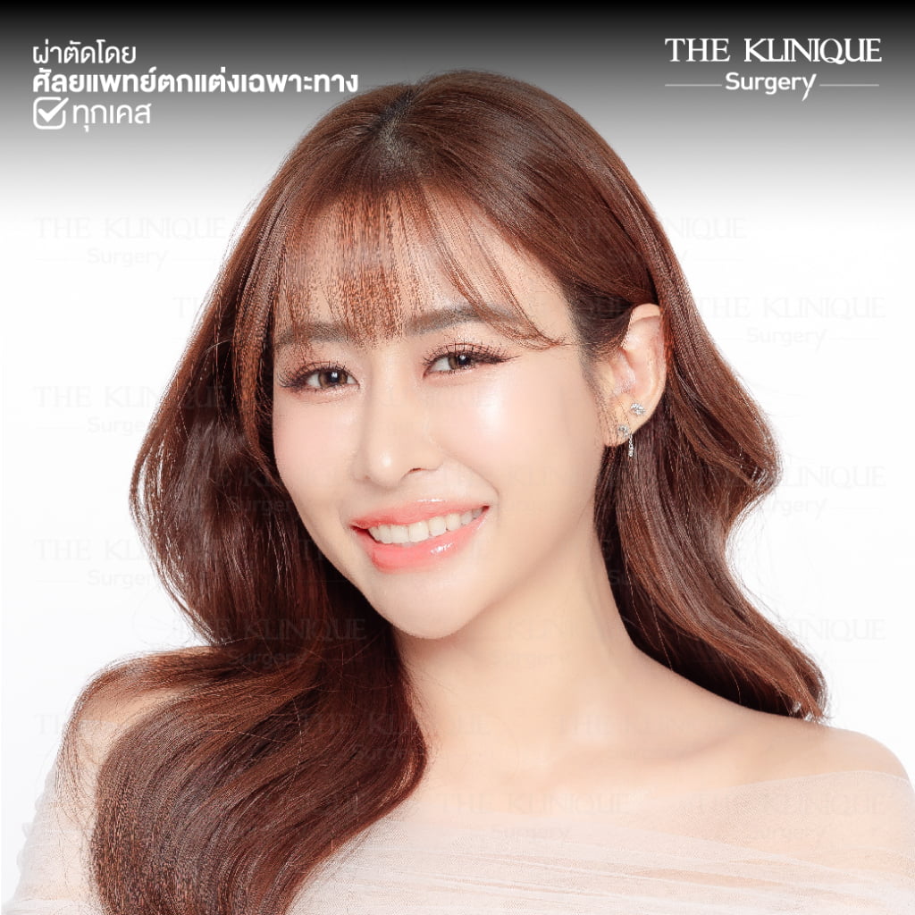 ทรงจมูก, ทรงจมูกสวย, ทรงจมูกเกาหลี, ทรงจมูกธรรมชาติ, ทรงจมูกสันสโลปปลายพุ่ง, ศัลยกรรมจมูก, เสริมจมูก, เสริมจมูกที่ไหนดี, เสริมจมูกราคา, รีวิว เสริมจมูก, ทำจมูก, ทำจมูก รีวิว,เสริมจมูก Semi Open, เสริมจมูก Open, เสริมจมูก โอเพ่น, ซิลิโคนจมูก, จมูกOpen, รีวิวเสริมจมูกโอเพ่น, รีวิวเสริมจมูก Open