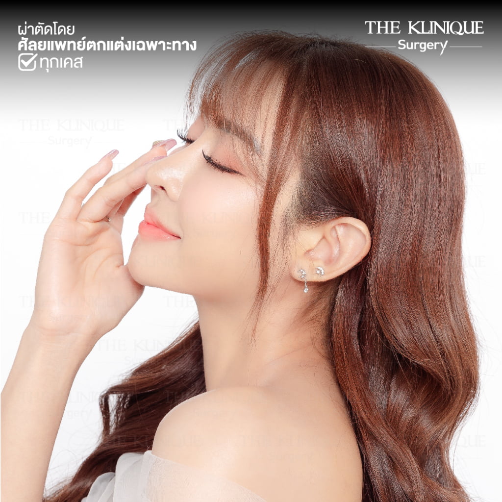 ทรงจมูก, ทรงจมูกสวย, ทรงจมูกเกาหลี, ทรงจมูกธรรมชาติ, ทรงจมูกสันสโลปปลายพุ่ง, ศัลยกรรมจมูก, เสริมจมูก, เสริมจมูกที่ไหนดี, เสริมจมูกราคา, รีวิว เสริมจมูก, ทำจมูก, ทำจมูก รีวิว,เสริมจมูก Semi Open, เสริมจมูก Open, เสริมจมูก โอเพ่น, ซิลิโคนจมูก, จมูกOpen, รีวิวเสริมจมูกโอเพ่น, รีวิวเสริมจมูก Open