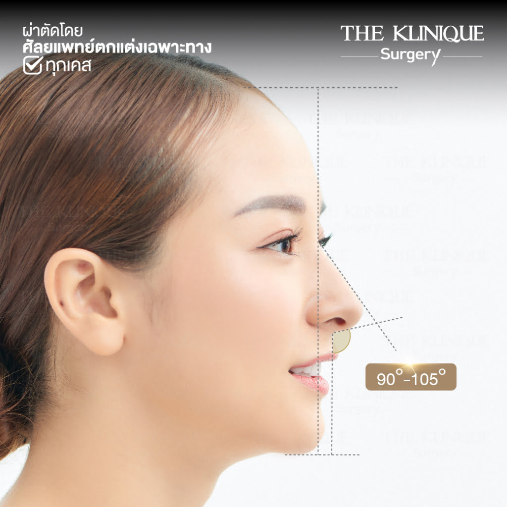 เสริมจมูก, ศัลยกรรมจมูก, ศัลยกรรมจมูก รีวิว, รีวิว เสริมจมูก, ศัลยกรรมจมูกมีกี่แบบ, เสริมจมูกที่ไหนดี, เสริมจมูกโอเพ่น, เสริมจมูกราคา, รีวิวเสริมจมูก, ทำจมูก, ทำจมูก รีวิว, รีวิวทำจมูก, รีวิว ศัลยกรรมจมูก, ซิลิโคนจมูก, แก้จมูก, แก้จมูก รีวิว, รีวิวแก้จมูก, แก้จมูกที่ไหนดี, เสริมจมูก Close, เสริมจมูก semi open, จมูก open, เสริมจมูก Open ที่ไหนดี, รีวิว เสริมจมูก Open, เสริมจมูกโอเพ่น, เสริมจมูกโอเพ่นที่ไหนดี, ทรงจมูก, ทรงจมูกสวย, ทรงจมูกเกาหลี, ทรงจมูกธรรมชาติ, ทรงจมูกสโลปปลายพุ่ง, ทรงจมูกผู้ชาย