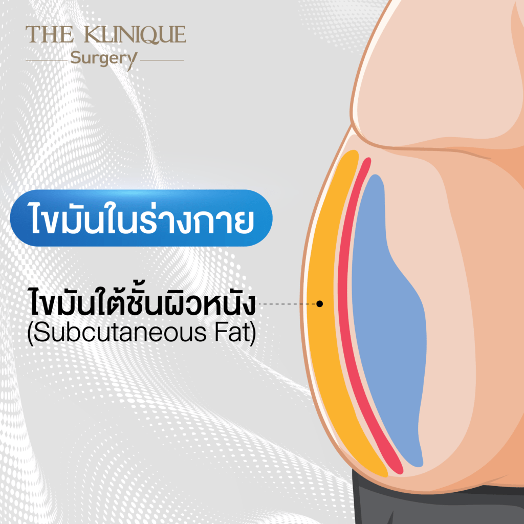 Liposuction, Sculpting,Xshape,Lipo, ศัลยกรรมดูดไขมัน, ดูดไขมัน,คลินิกดูดไขมัน,ดูดไขมันเฉพาะส่วน,ดูดไขมันเหนียง,ดูดไขมันหน้าท้อง,ดูดไขมันรีวิว, รีวิวดูดไขมัน, รีวิวดูดไขมันหน้าท้อง,ดูดไขมันต้นแขน, ดูดไขมันต้นขา,ดูดไขมันน่อง, ลดความอ้วน, ดูดไขมันที่ไหนดี, ดูดไขมันราคา, ดูดไขมันทั้งตัว