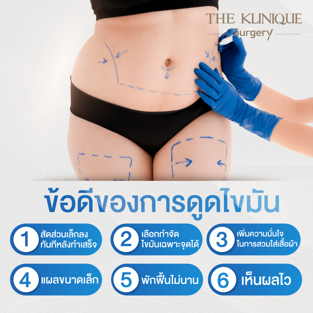 Liposuction, Sculpting,Xshape,Lipo, ศัลยกรรมดูดไขมัน, ดูดไขมัน,คลินิกดูดไขมัน,ดูดไขมันเฉพาะส่วน,ดูดไขมันเหนียง,ดูดไขมันหน้าท้อง,ดูดไขมันรีวิว, รีวิวดูดไขมัน, รีวิวดูดไขมันหน้าท้อง,ดูดไขมันต้นแขน, ดูดไขมันต้นขา,ดูดไขมันน่อง, ลดความอ้วน, ดูดไขมันที่ไหนดี, ดูดไขมันราคา, ดูดไขมันทั้งตัว