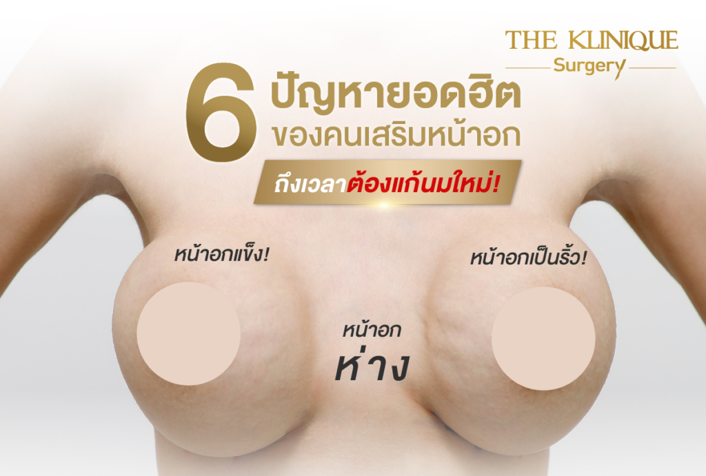 ทำหน้าอก, เสริมหน้าอก, ศัลยกรรมหน้าอก, เสริมหน้าอกที่ไหนดี, แก้หน้าอก, แก้หน้าอกที่ไหนดี, เสริมหน้าอกราคา, แก้หน้าอก ราคา, รีวิวแก้หน้าอก, รีวิวเสริมหน้าอก, แก้หน้าอกไม่เท่ากัน, ทำหน้าอก, ทำนม, ซิลิโคนหน้าอก