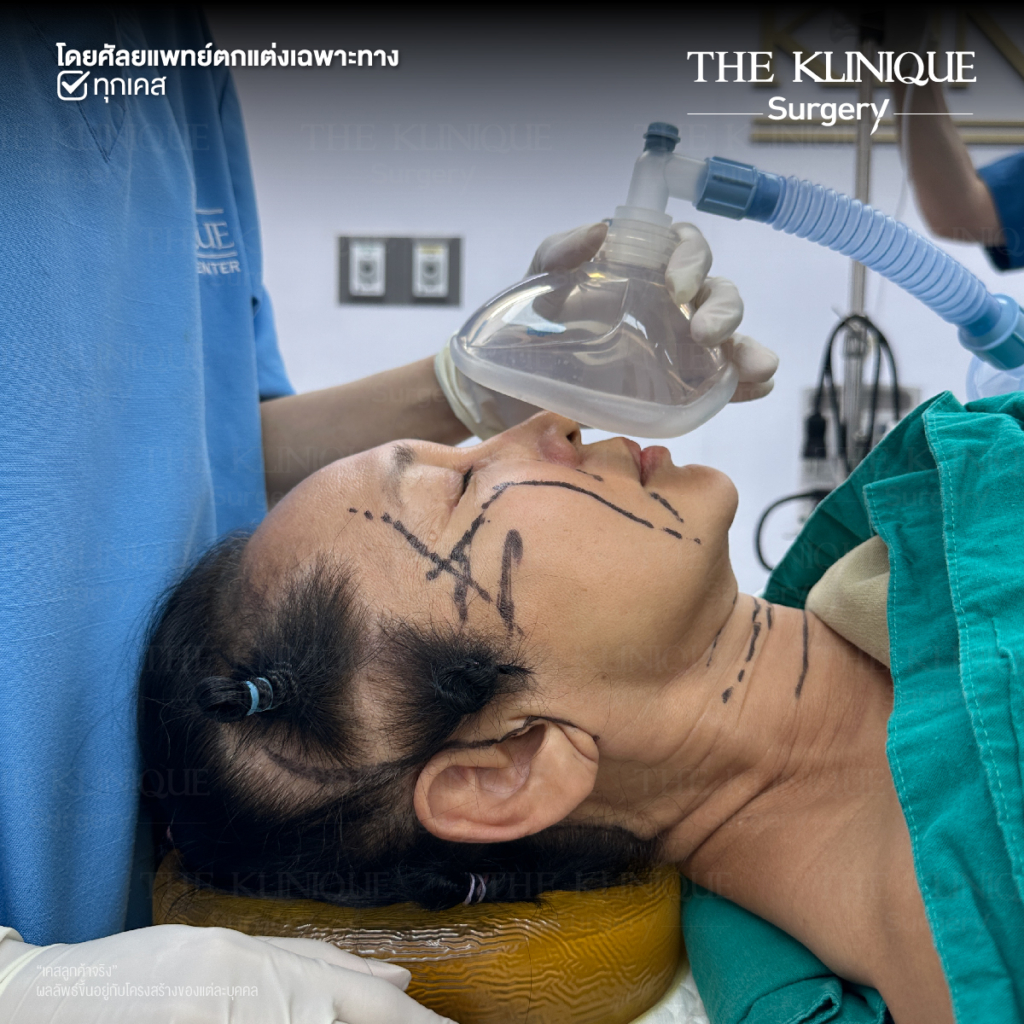 ดึงหน้าดารา, ดึงหน้าย้อนวัย, Facelift, ดึงหน้า ดึงคอ, ดึงหน้า Facelift,ดึงหน้า, ศัลยกรรมดึงหน้า, ดึงหน้า Face Lock, Face Lock, HollyWood Face Lock, เฟซล็อก, เฟซล็อค, เฟสล็อก, เฟสล็อค, ดึงหน้าเฟซล็อค, ดึงหน้าย้อนวัน, ดึงหน้ายกกระชับ, ยกกระชับผิว, หน้าเด็ก, ดึงหน้าที่ไหนดี, ผ่าตัดดึงหน้า, ผ้าตัดส่องกล้อง, ดึงหน้า ซ่อนแผล