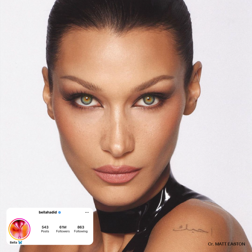 Foxy Eyes, ศัลยกรรมตา, ตาสองชั้น, คลินิกทำตา, ทำตาสองชั้น. ทำตา2ชั้น, กล้ามเนื้อตาอ่อนแรง, แก้ตา, แก้หนังตาตก,หางตาตก, ตาตก,ยกหางตา, แก้ตา, แก้ตาสองชั้น, แก้หนังตาตก , แก้ตาไม่เท่ากัน ,หนังตาตก,แก้หนังตาตก