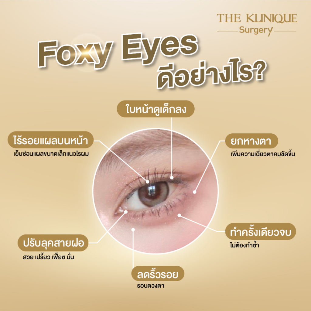 Foxy Eyes, ศัลยกรรมตา, ตาสองชั้น, คลินิกทำตา, ทำตาสองชั้น. ทำตา2ชั้น, กล้ามเนื้อตาอ่อนแรง, แก้ตา, แก้หนังตาตก,หางตาตก, ตาตก,ยกหางตา, แก้ตา, แก้ตาสองชั้น, แก้หนังตาตก , แก้ตาไม่เท่ากัน ,หนังตาตก,แก้หนังตาตก