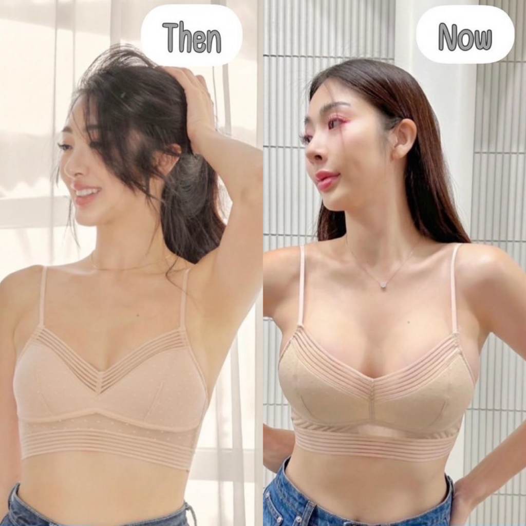 ทำหน้าอก, เสริมหน้าอก, ศัลยกรรมหน้าอก, เสริมหน้าอกที่ไหนดี, แก้หน้าอก, แก้หน้าอกที่ไหนดี, เสริมหน้าอกราคา, แก้หน้าอก ราคา, รีวิวแก้หน้าอก, รีวิวเสริมหน้าอก, แก้หน้าอกไม่เท่ากัน, ทำหน้าอก, ทำนม, ซิลิโคนหน้าอก