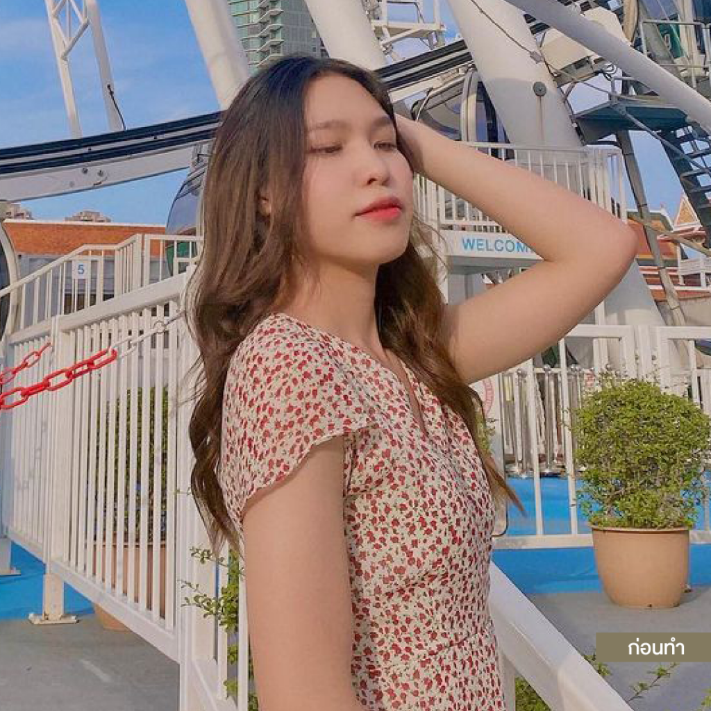 ทำหน้าอก, เสริมหน้าอก, ศัลยกรรมหน้าอก, เสริมหน้าอกที่ไหนดี, แก้หน้าอก, แก้หน้าอกที่ไหนดี, เสริมหน้าอกราคา, แก้หน้าอก ราคา, รีวิวแก้หน้าอก, รีวิวเสริมหน้าอก, แก้หน้าอกไม่เท่ากัน, ทำหน้าอก, ทำนม, ซิลิโคนหน้าอก
