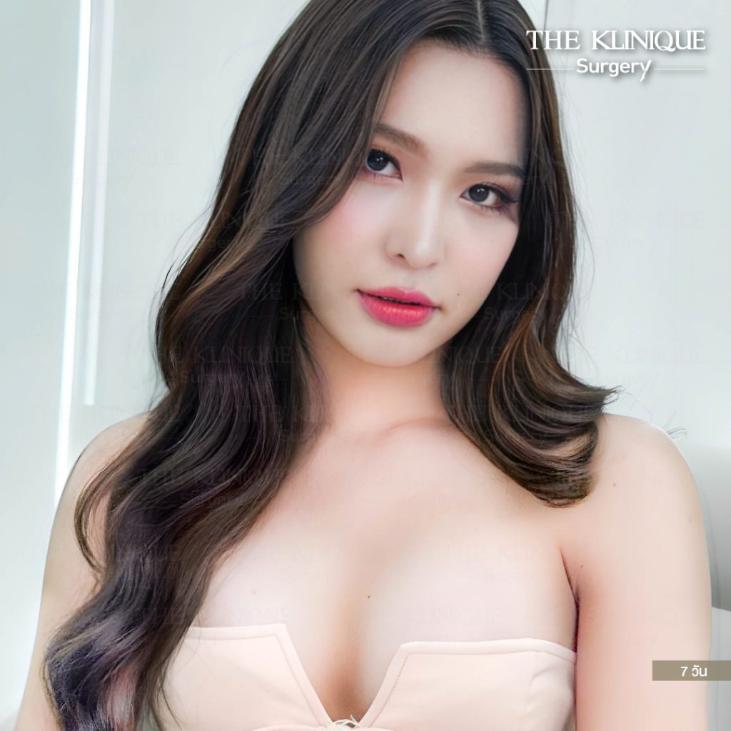เสริมหน้าอก, ศัลยกรรมหน้าอก, เสริมหน้าอกที่ไหนดี, แก้หน้าอก, แก้หน้าอกที่ไหนดี, เสริมหน้าอกราคา, แก้หน้าอก ราคา, รีวิวแก้หน้าอก, รีวิวเสริมหน้าอก, แก้หน้าอกไม่เท่ากัน, ทำหน้าอก, ทำนม, ซิลิโคนหน้าอก
