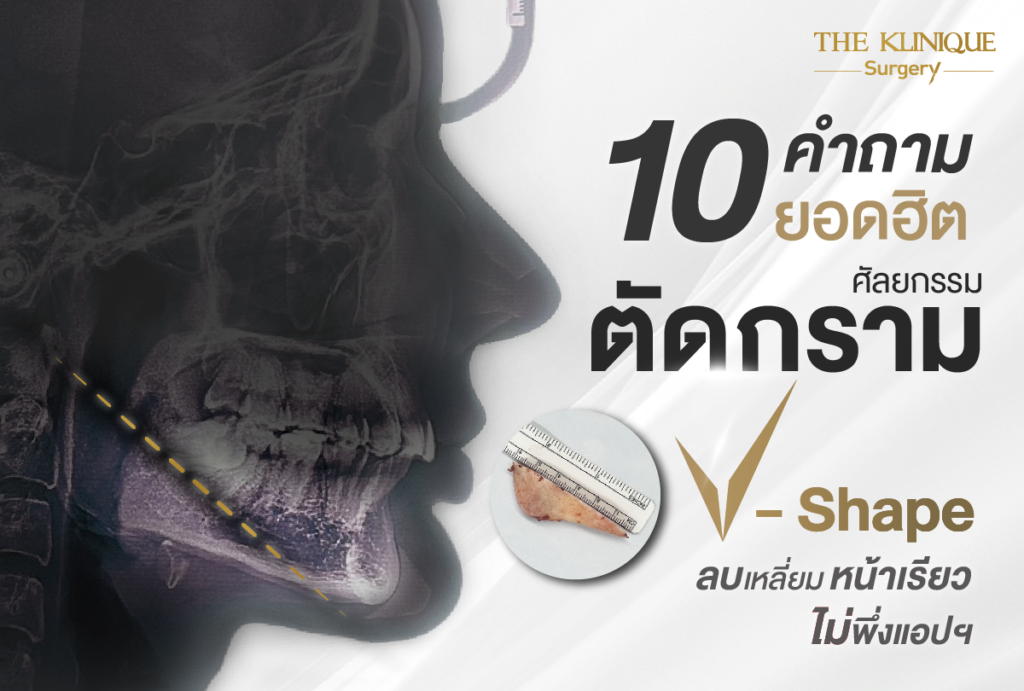 ตัดกราม, ศัลยกรรมตัดกราม, เหลากราม, ตัดกราม วีไลน์, ตัดกราม V-Line, ตัดกรามที่ไหนดี, ตัดกราม ราคา รีวิวตัดกราม, เหลากราม, รีวิว เหลากราม, ลดกราม, ยุบโหนก ตัดกราม