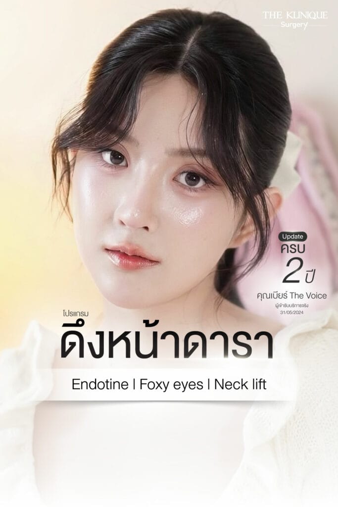 ดึงหน้า, ศัลยกรรมดึงหน้า,ดึงหน้าย้อนวัย, ดึงหน้าที่ไหนดี, ผ่าตัดดึงหน้า, ยกคิ้ว, ยกหางตา, ดึงหน้าดารา, ดึงหน้ารีวิว, Facelift, Endotine, ยกคิ้ว Endotine,ยกคิ้ว รีวิว, ยกคิ้วส่องกล้อง, ยกคิ้วที่ไหนดี,ศัลยกรรมยกคิ้ว