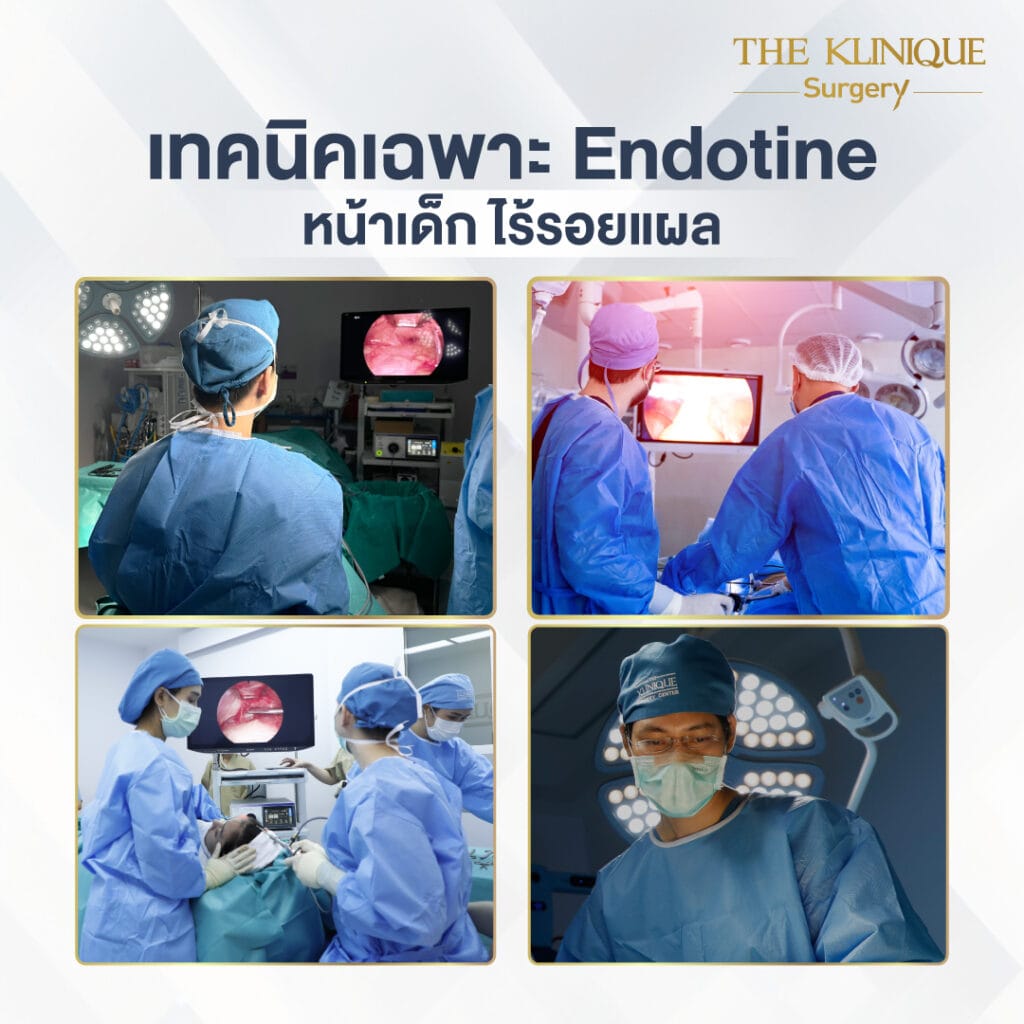 ยกคิ้วที่ไหนดี ศัลยกรรมยกคิ้ว Endotine หน้าเด็ก 2026