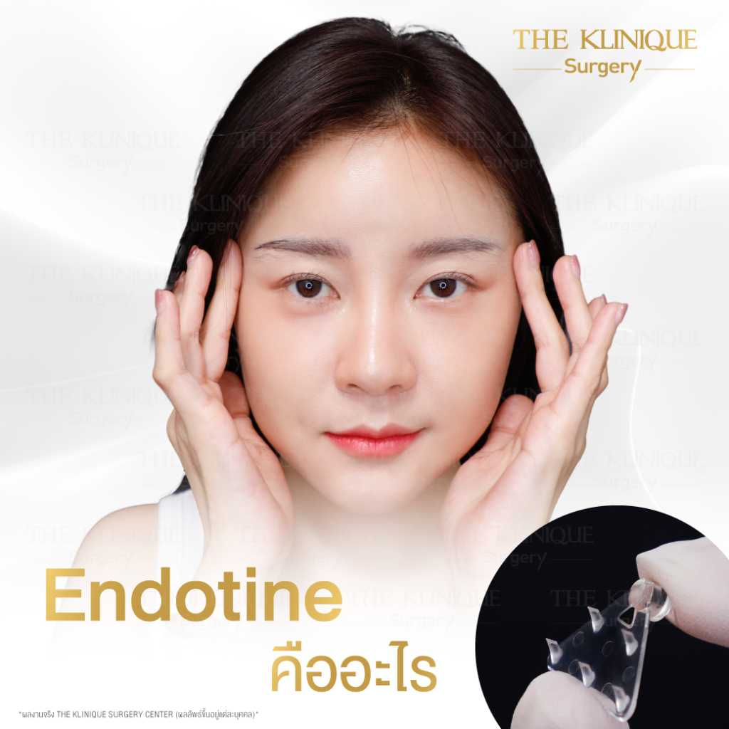 ดึงหน้า, ศัลยกรรมดึงหน้า,ดึงหน้าย้อนวัย, ดึงหน้าที่ไหนดี, ผ่าตัดดึงหน้า, ยกคิ้ว, ยกหางตา, หางตาตก, ดึงหน้าดารา, ดึงหน้ารีวิว, Facelift, Neck lift, Endotine, ยกคิ้ว Endotine,Foxy Eyes, แก้หนังตาตก , แก้ตาไม่เท่ากัน ,หนังตาตก,แก้หนังตาตก,ยกคิ้ว รีวิว, ยกคิ้วส่องกล้อง, ยกคิ้วที่ไหนดี, ยกคิ้ว,ศัลยกรรมยกคิ้ว