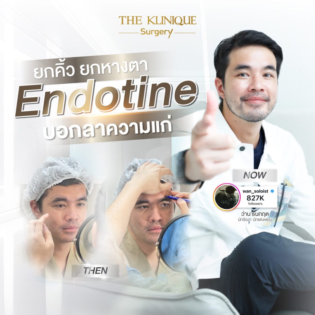 เปิดรีวิว ครั้งแรก! ว่าน ธนกฤต Endotine ยกหางตา บอกลาความแก่ - theklinique