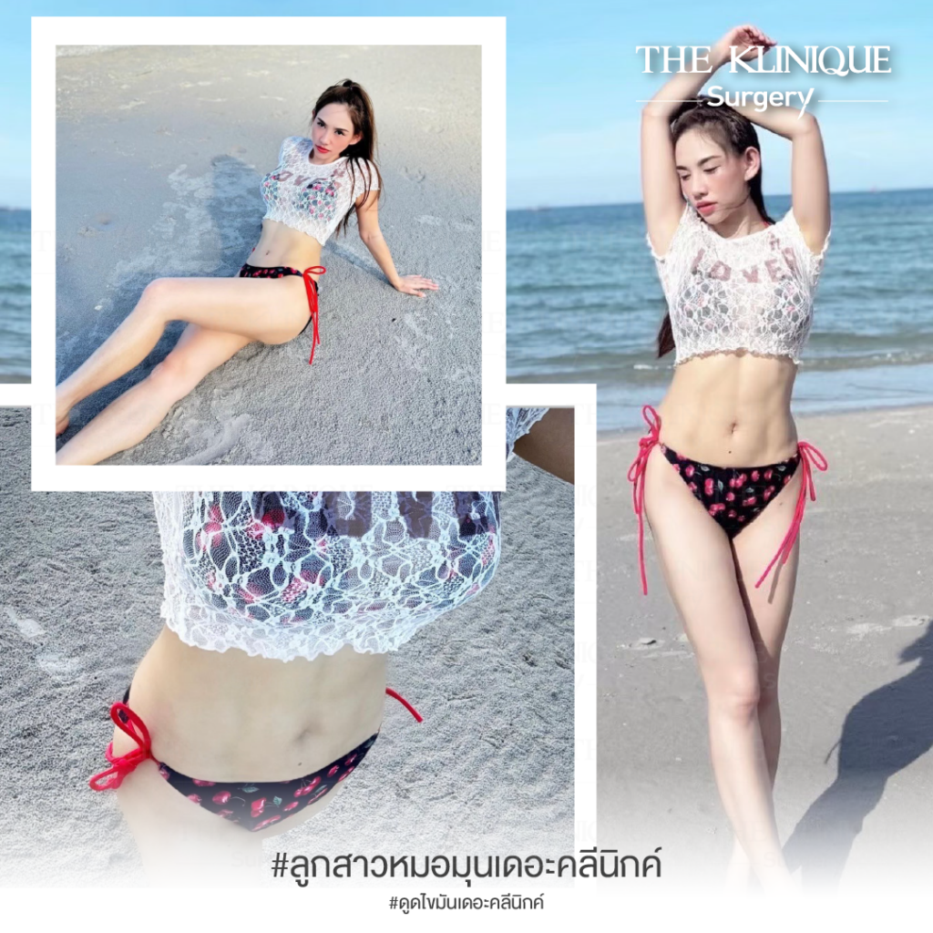 เสริมหน้าอก, ศัลยกรรมหน้าอก, เสริมหน้าอกที่ไหนดี, แก้หน้าอก, แก้หน้าอกที่ไหนดี, เสริมหน้าอกราคา, แก้หน้าอก ราคา, รีวิวแก้หน้าอก, รีวิวเสริมหน้าอก, แก้หน้าอกไม่เท่ากัน, ทำหน้าอก, ทำนม, ซิลิโคนหน้าอก