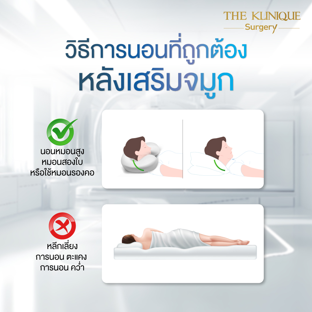 ศัลยกรรมจมูก, เสริมจมูก, เสริมจมูกที่ไหนดี, เสริมจมูกราคา, รีวิว เสริมจมูก, ทำจมูก, ทำจมูก รีวิว,เสริมจมูก Semi Open, เสริมจมูก Open, เสริมจมูก โอเพ่น, ซิลิโคนจมูก, จมูกOpen, รีวิวเสริมจมูกโอเพ่น, รีวิวเสริมจมูก Open, ทรงจมูก, ทรงจมูกสวย, ทรงจมูกเกาหลี, ทรงจมูกธรรมชาติ, ทรงจมูกสันสโลปปลายพุ่ง,รีวิวจมูกOpen, หลังเสริมจมูก