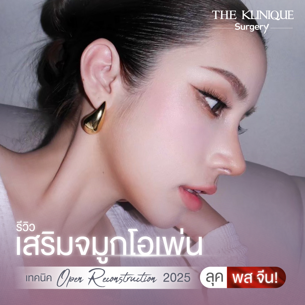 ศัลยกรรมจมูก, เสริมจมูก, เสริมจมูกที่ไหนดี, เสริมจมูกราคา, รีวิว เสริมจมูก, ทำจมูก, ทำจมูก รีวิว,เสริมจมูก Semi Open, เสริมจมูก Open, เสริมจมูก โอเพ่น, ซิลิโคนจมูก, จมูกOpen, รีวิวเสริมจมูกโอเพ่น, รีวิวเสริมจมูก Open, ทรงจมูก, ทรงจมูกสวย, ทรงจมูกเกาหลี, ทรงจมูกธรรมชาติ, ทรงจมูกสันสโลปปลายพุ่ง