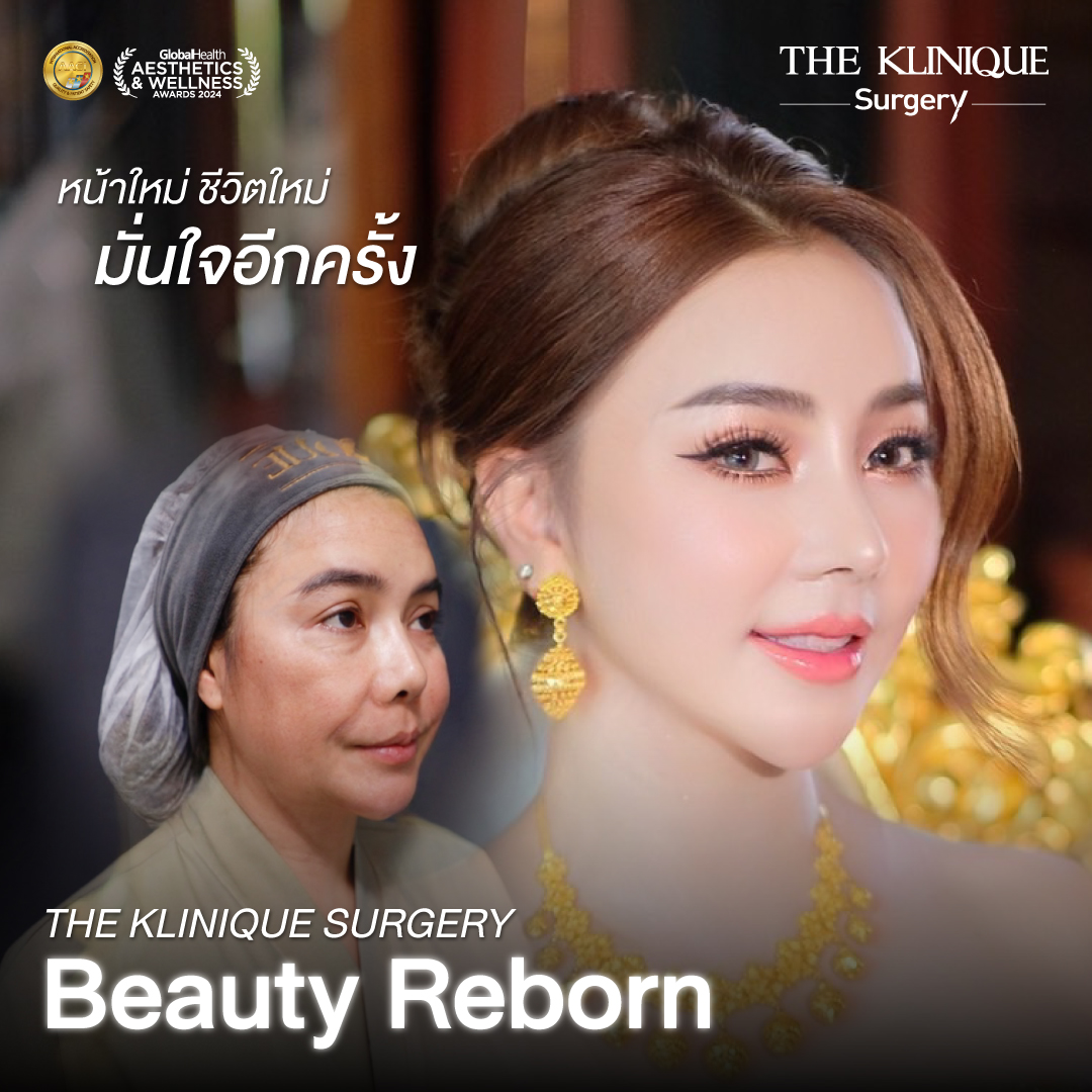 ศัลยกรรมดึงหน้า, ดึงหน้า, ดึงหน้าผาก, ดึงหน้าผาก ยกคิ้ว, Face Lock, Face Lift, ดึงหน้า ดึงคอ, ดึงหน้าย้อนวัย, ดึงหน้าดารา, Necklift, Face Lift คือ,Endotine หน้าผาก,ดึงหน้าผาก ยกคิ้ว, ศัลยกรรมดึงหน้าผาก, ดึงหน้าย้อนวัย, ศัลยกรรมยกคิ้ว, รีวิวศัลยกรรมยกคิ้ว, Endotine, Endotine รีวิว, ยกคิ้วส่องกล้อง, ผ่าตัดส่องกล้อง, ผ่าตัดดึงหน้า, Endotine รีวิว, ยกคิ้ว รีวิว, ยกคิ้วส่องกล้อง, ยกคิ้วส่องกล้อง รีวิว, ยกคิ้วที่ไหนดี