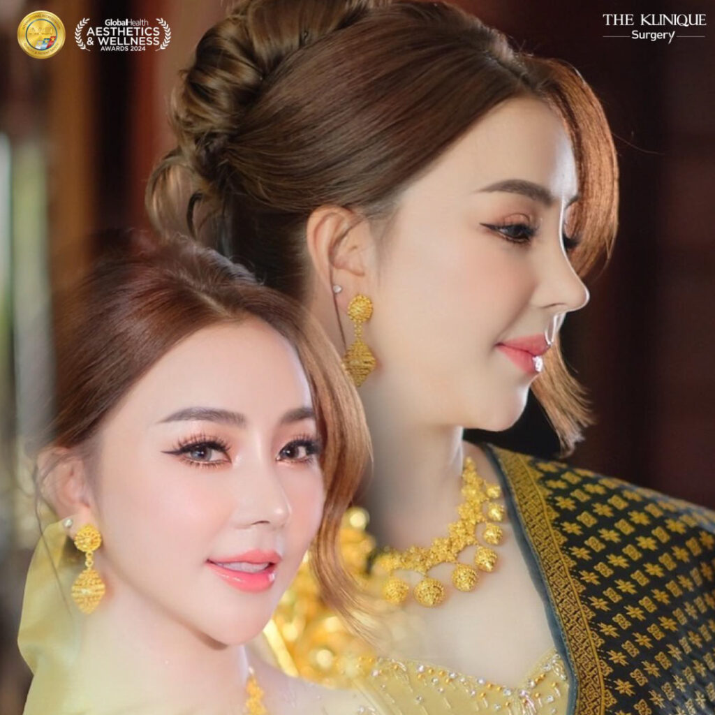 ศัลยกรรมดึงหน้า, ดึงหน้า, ดึงหน้าผาก, ดึงหน้าผาก ยกคิ้ว, Face Lock, Face Lift, ดึงหน้า ดึงคอ, ดึงหน้าย้อนวัย, ดึงหน้าดารา, Necklift, Face Lift คือ,Endotine หน้าผาก,ดึงหน้าผาก ยกคิ้ว, ศัลยกรรมดึงหน้าผาก, ดึงหน้าย้อนวัย, ศัลยกรรมยกคิ้ว, รีวิวศัลยกรรมยกคิ้ว, Endotine, Endotine รีวิว, ยกคิ้วส่องกล้อง, ผ่าตัดส่องกล้อง, ผ่าตัดดึงหน้า, Endotine รีวิว, ยกคิ้ว รีวิว, ยกคิ้วส่องกล้อง, ยกคิ้วส่องกล้อง รีวิว, ยกคิ้วที่ไหนดี
