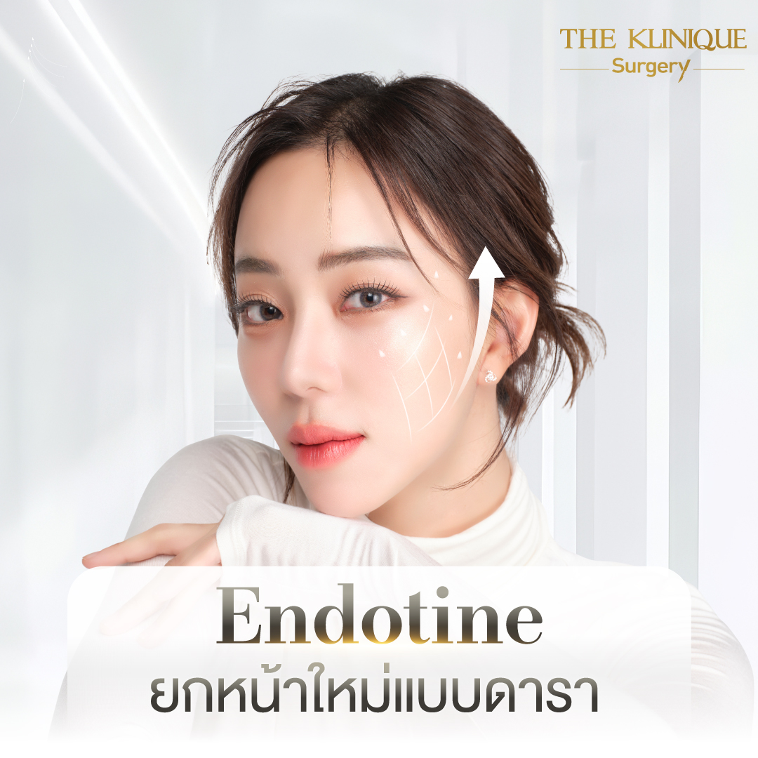 ศัลยกรรมดึงหน้า, ดึงหน้า, ดึงหน้าผาก, ดึงหน้าผาก ยกคิ้ว, Face Lock, Face Lift, ดึงหน้า ดึงคอ, ดึงหน้าย้อนวัย, ดึงหน้าดารา, Necklift, Face Lift คือ,Endotine หน้าผาก,ดึงหน้าผาก ยกคิ้ว, ศัลยกรรมดึงหน้าผาก, ดึงหน้าย้อนวัย, ศัลยกรรมยกคิ้ว, รีวิวศัลยกรรมยกคิ้ว, Endotine, Endotine รีวิว, ยกคิ้วส่องกล้อง, ผ่าตัดส่องกล้อง, ผ่าตัดดึงหน้า, Endotine รีวิว, ยกคิ้ว รีวิว, ยกคิ้วส่องกล้อง, ยกคิ้วส่องกล้อง รีวิว, ยกคิ้วที่ไหนดี