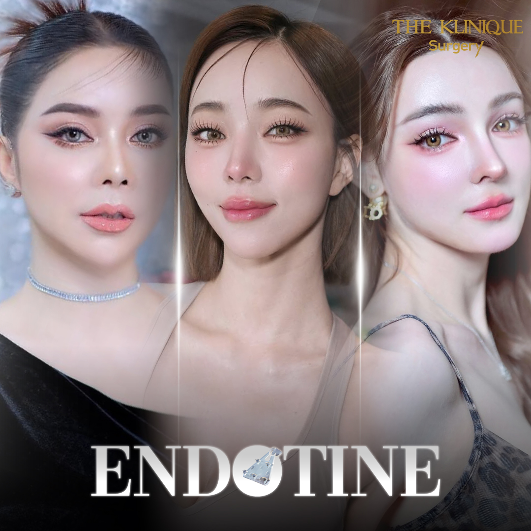 ศัลยกรรมดึงหน้า, ดึงหน้า, ดึงหน้าผาก, ดึงหน้าผาก ยกคิ้ว, Face Lock, Face Lift, ดึงหน้า ดึงคอ, ดึงหน้าย้อนวัย, ดึงหน้าดารา, Necklift, Face Lift คือ,Endotine หน้าผาก,ดึงหน้าผาก ยกคิ้ว, ศัลยกรรมดึงหน้าผาก, ดึงหน้าย้อนวัย, ศัลยกรรมยกคิ้ว, รีวิวศัลยกรรมยกคิ้ว, Endotine, Endotine รีวิว, ยกคิ้วส่องกล้อง, ผ่าตัดส่องกล้อง, ผ่าตัดดึงหน้า, Endotine รีวิว, ยกคิ้ว รีวิว, ยกคิ้วส่องกล้อง, ยกคิ้วส่องกล้อง รีวิว, ยกคิ้วที่ไหนดี