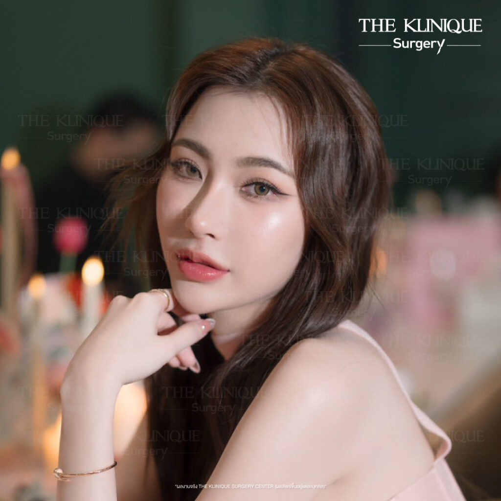 ศัลยกรรมจมูก, เสริมจมูก, เสริมจมูกที่ไหนดี, เสริมจมูกราคา, รีวิว เสริมจมูก, ทำจมูก, ทำจมูก รีวิว,เสริมจมูก Semi Open, เสริมจมูก Open, เสริมจมูก โอเพ่น, ซิลิโคนจมูก, จมูกOpen, รีวิวเสริมจมูกโอเพ่น, รีวิวเสริมจมูก Open, ทรงจมูก, ทรงจมูกสวย, ทรงจมูกเกาหลี, ทรงจมูกธรรมชาติ, ทรงจมูกสันสโลปปลายพุ่ง,รีวิวจมูกOpen, หลังเสริมจมูก, ศัลยกรรมเสริมจมูก, ศัลยกรรมเสริมจมูกราคา, ศัลยกรรมเสริมจมูกที่ไหนดี, เสริมจมูกที่ไหนดี, ศัลยกรรมจมูกมีกี่แบบ, เสริมจมูก Close, เสริมจมูก Open ที่ไหนดี, เสริมจมูกโอเพ่นทีไ่หนดี, รีวิวจมูกOpen, รีวิวเสริมจมูกOpen, แก้จมูก, แก้จมูกที่ไหนดี,