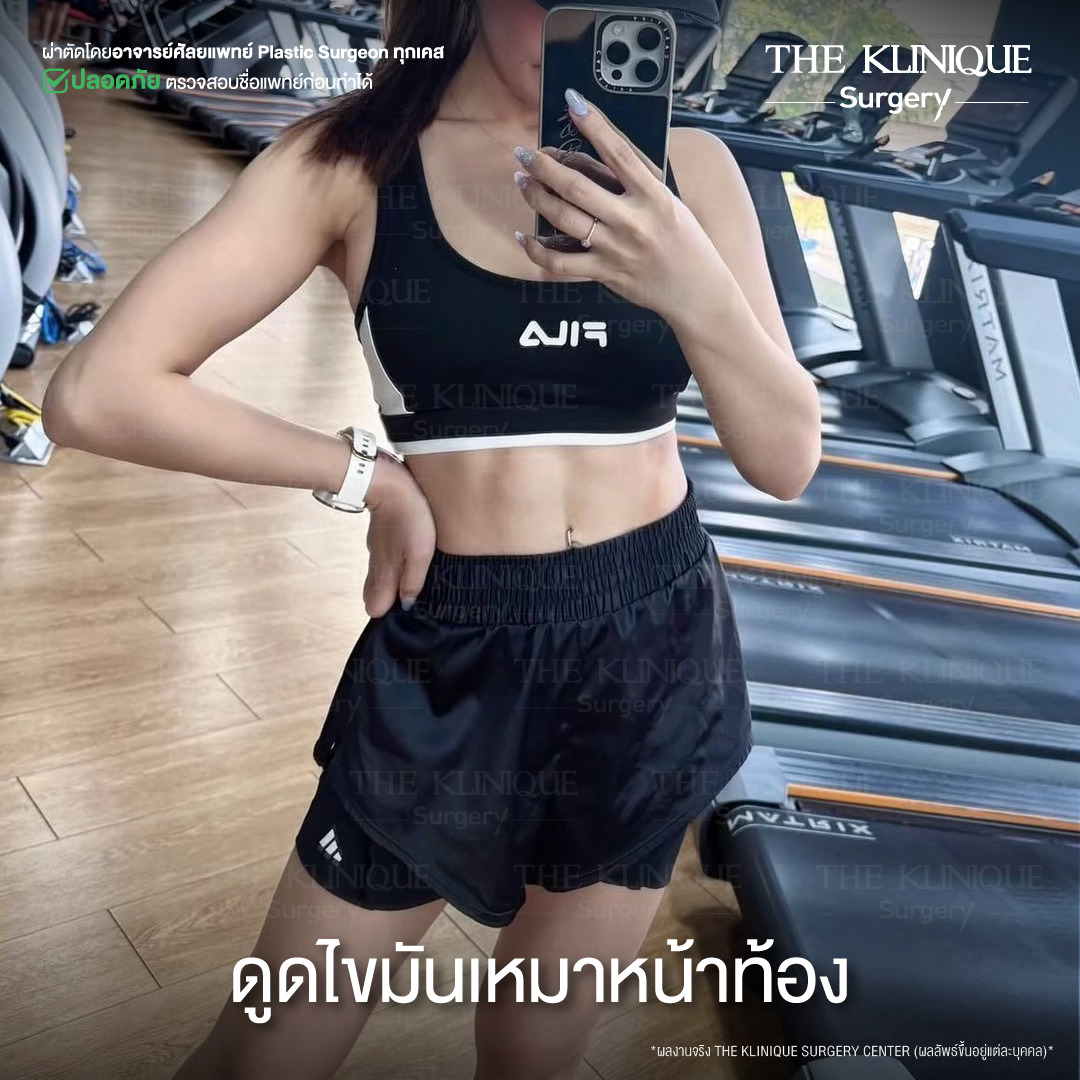 Liposuction, Sculpting,Xshape,Lipo, ศัลยกรรมดูดไขมัน, ดูดไขมัน,คลินิกดูดไขมัน,ดูดไขมันเฉพาะส่วน,ดูดไขมันเหนียง,ดูดไขมันหน้าท้อง,ดูดไขมันรีวิว, รีวิวดูดไขมัน, รีวิวดูดไขมันหน้าท้อง,ดูดไขมันต้นแขน, ดูดไขมันต้นขา,ดูดไขมันน่อง, ลดความอ้วน, ดูดไขมันที่ไหนดี, ดูดไขมันราคา, ดูดไขมันทั้งตัว, รีวิว ดูดไขมันต้นขา, ดูดไขมันขา