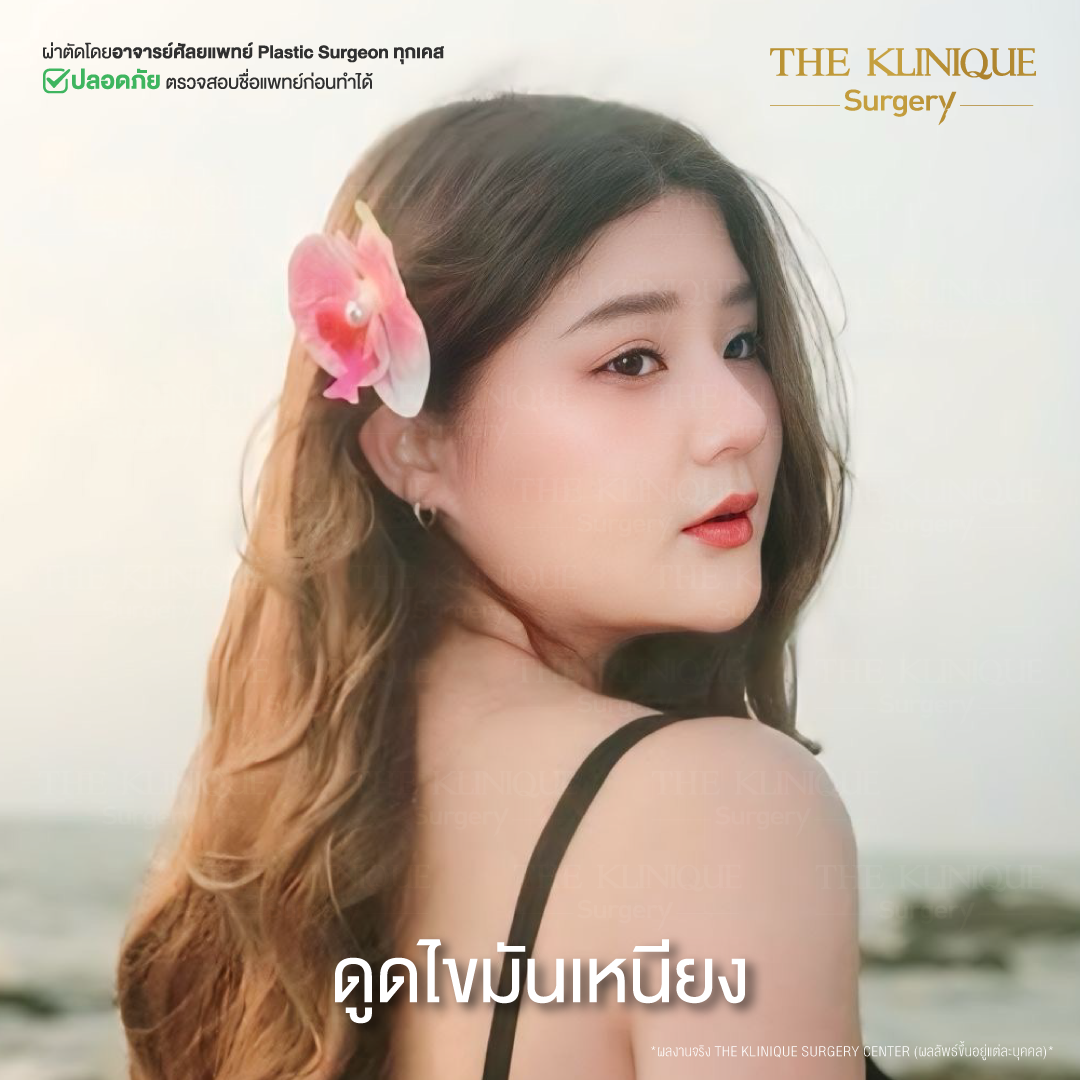 Liposuction, Sculpting,Xshape,Lipo, ศัลยกรรมดูดไขมัน, ดูดไขมัน,คลินิกดูดไขมัน,ดูดไขมันเฉพาะส่วน,ดูดไขมันเหนียง,ดูดไขมันหน้าท้อง,ดูดไขมันรีวิว, รีวิวดูดไขมัน, รีวิวดูดไขมันหน้าท้อง,ดูดไขมันต้นแขน, ดูดไขมันต้นขา,ดูดไขมันน่อง, ลดความอ้วน, ดูดไขมันที่ไหนดี, ดูดไขมันราคา, ดูดไขมันทั้งตัว, รีวิว ดูดไขมันต้นขา, ดูดไขมันขา