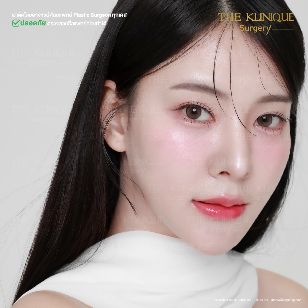 ศัลยกรรมจมูก, ศัลยกรรมจมูก รีวิว, เสริมจมูก, รีวิวเสริมจมูก, ทำจมูก, ทำจมูก รีวิว, ทำจมูก
แบบ Open, ซิลิโคนจมูก, จมูก Open, เสริมจมูกโอเพ่น, เสริมจมูกOpen ที่ไหนดี,  เสริมจมูกโอเพ่น  ที่ไหนดี,  เสริมจมูกโอเพ่น Open คือ, รีวิวเสริมจมูกโอเพ่น Open, ทรงจมูก, ทรงจมูกสวย, ทรงจมูกธรรมชาติ, ทรงจมูกสโลปปลายพุ่ง, ศัลยกรรมจมูกทีไ่หนดี, ศัลยกรรมจมูกมีกี่แบบ, เสริมจมูกที่ไหนดี, เสริมจมูกโอเพ่น, เสริมจมูกOpen, ทำจมูกรีวิว, ซิลิโคนจมูก,แก้จมูก, แก้จมูกที่ไหนดี, ทรงจมูกผู้ชาย, เสริมจมูกผู้ชาย, ศัลยฯจมูก, ถอดซิลิโคนจมูก, จมูก Semi Open