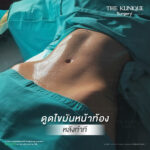 Liposuction, Sculpting,Xshape,Lipo, ศัลยกรรมดูดไขมัน, ดูดไขมัน,คลินิกดูดไขมัน,ดูดไขมันเฉพาะส่วน,ดูดไขมันเหนียง,ดูดไขมันหน้าท้อง,ดูดไขมันรีวิว, รีวิวดูดไขมัน, รีวิวดูดไขมันหน้าท้อง,ดูดไขมันต้นแขน, ดูดไขมันต้นขา,ดูดไขมันน่อง, ลดความอ้วน, ดูดไขมันที่ไหนดี, ดูดไขมันราคา, ดูดไขมันทั้งตัว, รีวิว ดูดไขมันต้นขา, ดูดไขมันขา