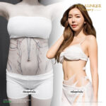 Liposuction, Sculpting,Xshape,Lipo, ศัลยกรรมดูดไขมัน, ดูดไขมัน,คลินิกดูดไขมัน,ดูดไขมันเฉพาะส่วน,ดูดไขมันเหนียง,ดูดไขมันหน้าท้อง,ดูดไขมันรีวิว, รีวิวดูดไขมัน, รีวิวดูดไขมันหน้าท้อง,ดูดไขมันต้นแขน, ดูดไขมันต้นขา,ดูดไขมันน่อง, ลดความอ้วน, ดูดไขมันที่ไหนดี, ดูดไขมันราคา, ดูดไขมันทั้งตัว, รีวิว ดูดไขมันต้นขา, ดูดไขมันขา