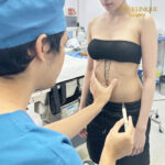 Liposuction, Sculpting,Xshape,Lipo, ศัลยกรรมดูดไขมัน, ดูดไขมัน,คลินิกดูดไขมัน,ดูดไขมันเฉพาะส่วน,ดูดไขมันเหนียง,ดูดไขมันหน้าท้อง,ดูดไขมันรีวิว, รีวิวดูดไขมัน, รีวิวดูดไขมันหน้าท้อง,ดูดไขมันต้นแขน, ดูดไขมันต้นขา,ดูดไขมันน่อง, ลดความอ้วน, ดูดไขมันที่ไหนดี, ดูดไขมันราคา, ดูดไขมันทั้งตัว, รีวิว ดูดไขมันต้นขา, ดูดไขมันขา