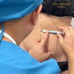 Liposuction, Sculpting,Xshape,Lipo, ศัลยกรรมดูดไขมัน, ดูดไขมัน,คลินิกดูดไขมัน,ดูดไขมันเฉพาะส่วน,ดูดไขมันเหนียง,ดูดไขมันหน้าท้อง,ดูดไขมันรีวิว, รีวิวดูดไขมัน, รีวิวดูดไขมันหน้าท้อง,ดูดไขมันต้นแขน, ดูดไขมันต้นขา,ดูดไขมันน่อง, ลดความอ้วน, ดูดไขมันที่ไหนดี, ดูดไขมันราคา, ดูดไขมันทั้งตัว, รีวิว ดูดไขมันต้นขา, ดูดไขมันขา