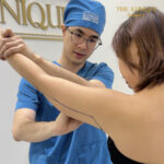 Liposuction, Sculpting,Xshape,Lipo, ศัลยกรรมดูดไขมัน, ดูดไขมัน,คลินิกดูดไขมัน,ดูดไขมันเฉพาะส่วน,ดูดไขมันเหนียง,ดูดไขมันหน้าท้อง,ดูดไขมันรีวิว, รีวิวดูดไขมัน, รีวิวดูดไขมันหน้าท้อง,ดูดไขมันต้นแขน, ดูดไขมันต้นขา,ดูดไขมันน่อง, ลดความอ้วน, ดูดไขมันที่ไหนดี, ดูดไขมันราคา, ดูดไขมันทั้งตัว, รีวิว ดูดไขมันต้นขา, ดูดไขมันขา