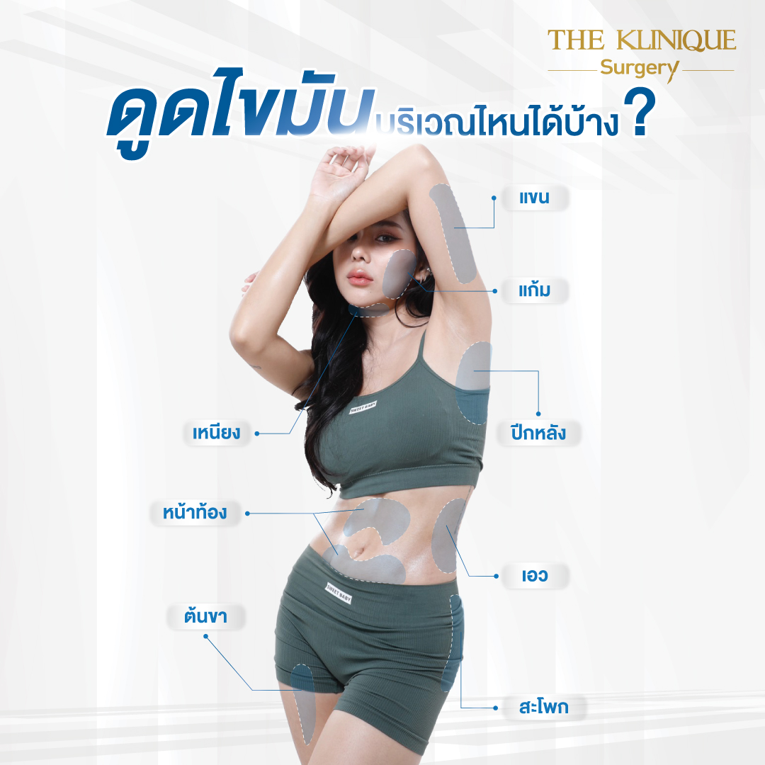 Liposuction, Sculpting,Xshape,Lipo, ศัลยกรรมดูดไขมัน, ดูดไขมัน,คลินิกดูดไขมัน,ดูดไขมันเฉพาะส่วน,ดูดไขมันเหนียง,ดูดไขมันหน้าท้อง,ดูดไขมันรีวิว, รีวิวดูดไขมัน, รีวิวดูดไขมันหน้าท้อง,ดูดไขมันต้นแขน, ดูดไขมันต้นขา,ดูดไขมันน่อง, ลดความอ้วน, ดูดไขมันที่ไหนดี, ดูดไขมันราคา, ดูดไขมันทั้งตัว, รีวิว ดูดไขมันต้นขา, ดูดไขมันขา