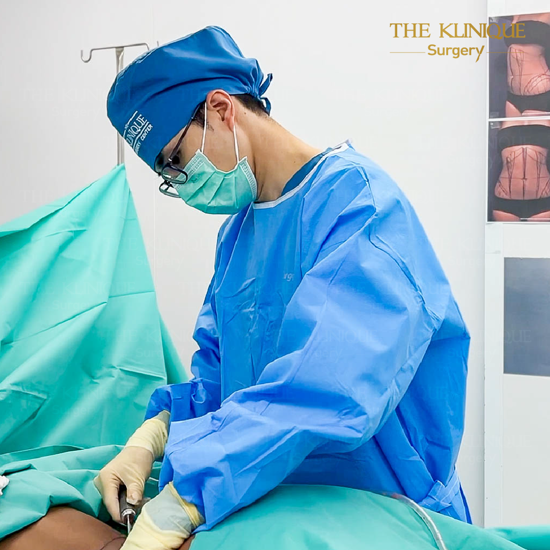 Liposuction, Sculpting,Xshape,Lipo, ศัลยกรรมดูดไขมัน, ดูดไขมัน,คลินิกดูดไขมัน,ดูดไขมันเฉพาะส่วน,ดูดไขมันเหนียง,ดูดไขมันหน้าท้อง,ดูดไขมันรีวิว, รีวิวดูดไขมัน, รีวิวดูดไขมันหน้าท้อง,ดูดไขมันต้นแขน, ดูดไขมันต้นขา,ดูดไขมันน่อง, ลดความอ้วน, ดูดไขมันที่ไหนดี, ดูดไขมันราคา, ดูดไขมันทั้งตัว, รีวิว ดูดไขมันต้นขา, ดูดไขมันขา
