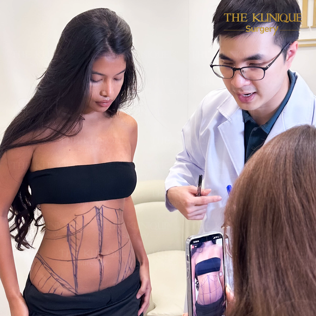 Liposuction, Sculpting,Xshape,Lipo, ศัลยกรรมดูดไขมัน, ดูดไขมัน,คลินิกดูดไขมัน,ดูดไขมันเฉพาะส่วน,ดูดไขมันเหนียง,ดูดไขมันหน้าท้อง,ดูดไขมันรีวิว, รีวิวดูดไขมัน, รีวิวดูดไขมันหน้าท้อง,ดูดไขมันต้นแขน, ดูดไขมันต้นขา,ดูดไขมันน่อง, ลดความอ้วน, ดูดไขมันที่ไหนดี, ดูดไขมันราคา, ดูดไขมันทั้งตัว, รีวิว ดูดไขมันต้นขา, ดูดไขมันขา