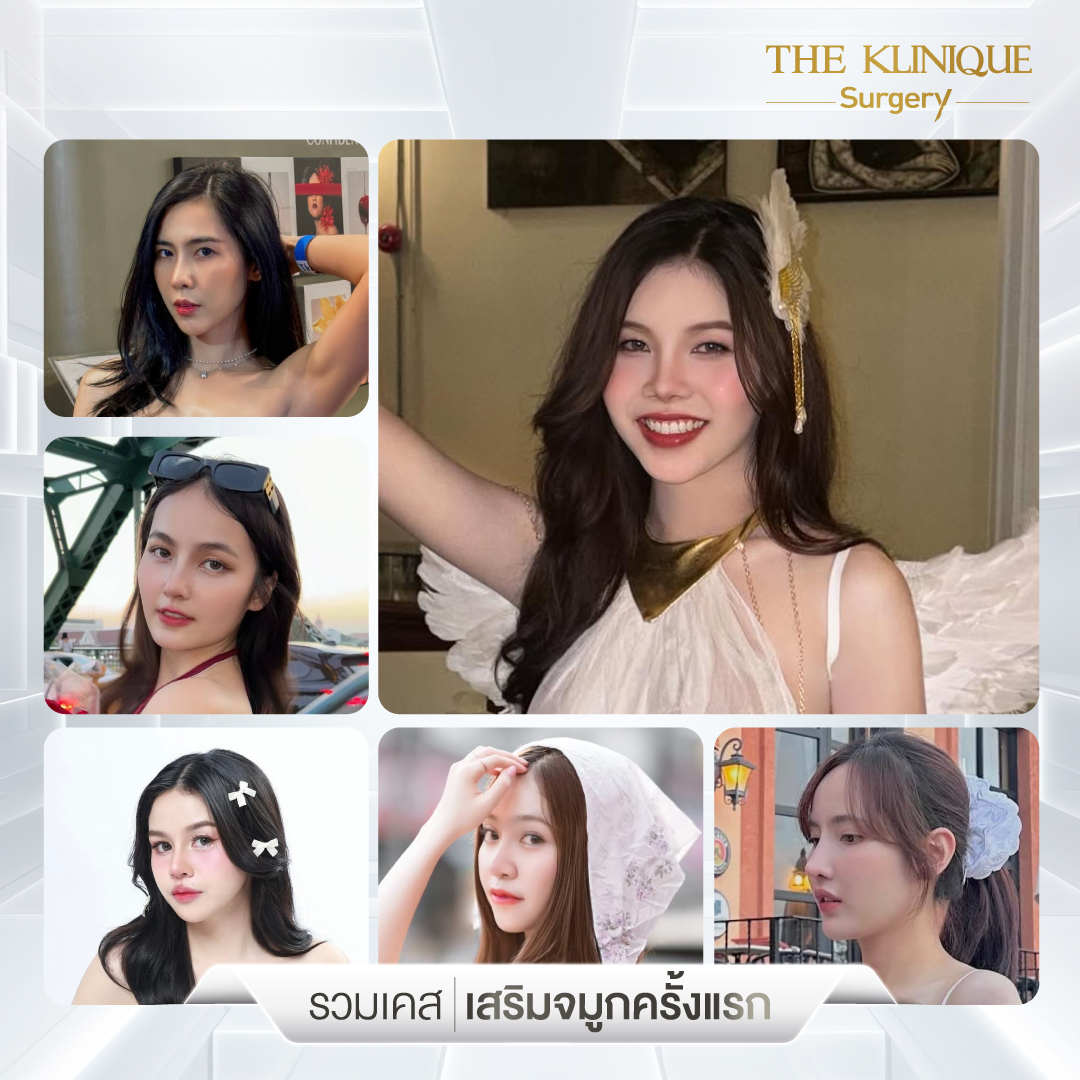 เสริมจมูก, ศัลยกรรมจมูก, ศัลยกรรมจมูก รีวิว, รีวิว เสริมจมูก, ศัลยกรรมจมูกมีกี่แบบ, เสริมจมูกที่ไหนดี, เสริมจมูกโอเพ่น, เสริมจมูกราคา, รีวิวเสริมจมูก, ทำจมูก, ทำจมูก รีวิว, รีวิวทำจมูก, รีวิว ศัลยกรรมจมูก, ซิลิโคนจมูก, แก้จมูก, แก้จมูก รีวิว, รีวิวแก้จมูก, แก้จมูกที่ไหนดี, เสริมจมูก Close, เสริมจมูก semi open, จมูก open, เสริมจมูก Open ที่ไหนดี, รีวิว เสริมจมูก Open, เสริมจมูกโอเพ่น, เสริมจมูกโอเพ่นที่ไหนดี, ทรงจมูก, ทรงจมูกสวย, ทรงจมูกเกาหลี, ทรงจมูกธรรมชาติ, ทรงจมูกสโลปปลายพุ่ง, ทรงจมูกผู้ชาย
