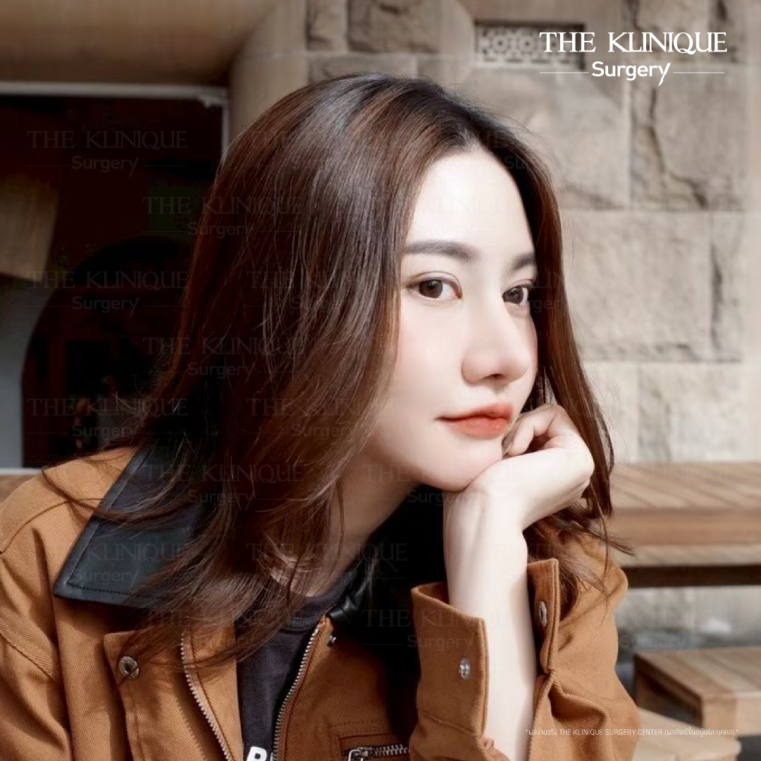 เสริมจมูก, ศัลยกรรมจมูก, ศัลยกรรมจมูก รีวิว, รีวิว เสริมจมูก, ศัลยกรรมจมูกมีกี่แบบ, เสริมจมูกที่ไหนดี, เสริมจมูกโอเพ่น, เสริมจมูกราคา, รีวิวเสริมจมูก, ทำจมูก, ทำจมูก รีวิว, รีวิวทำจมูก, รีวิว ศัลยกรรมจมูก, ซิลิโคนจมูก, แก้จมูก, แก้จมูก รีวิว, รีวิวแก้จมูก, แก้จมูกที่ไหนดี, เสริมจมูก Close, เสริมจมูก semi open, จมูก open, เสริมจมูก Open ที่ไหนดี, รีวิว เสริมจมูก Open, เสริมจมูกโอเพ่น, เสริมจมูกโอเพ่นที่ไหนดี, ทรงจมูก, ทรงจมูกสวย, ทรงจมูกเกาหลี, ทรงจมูกธรรมชาติ, ทรงจมูกสโลปปลายพุ่ง, ทรงจมูกผู้ชาย