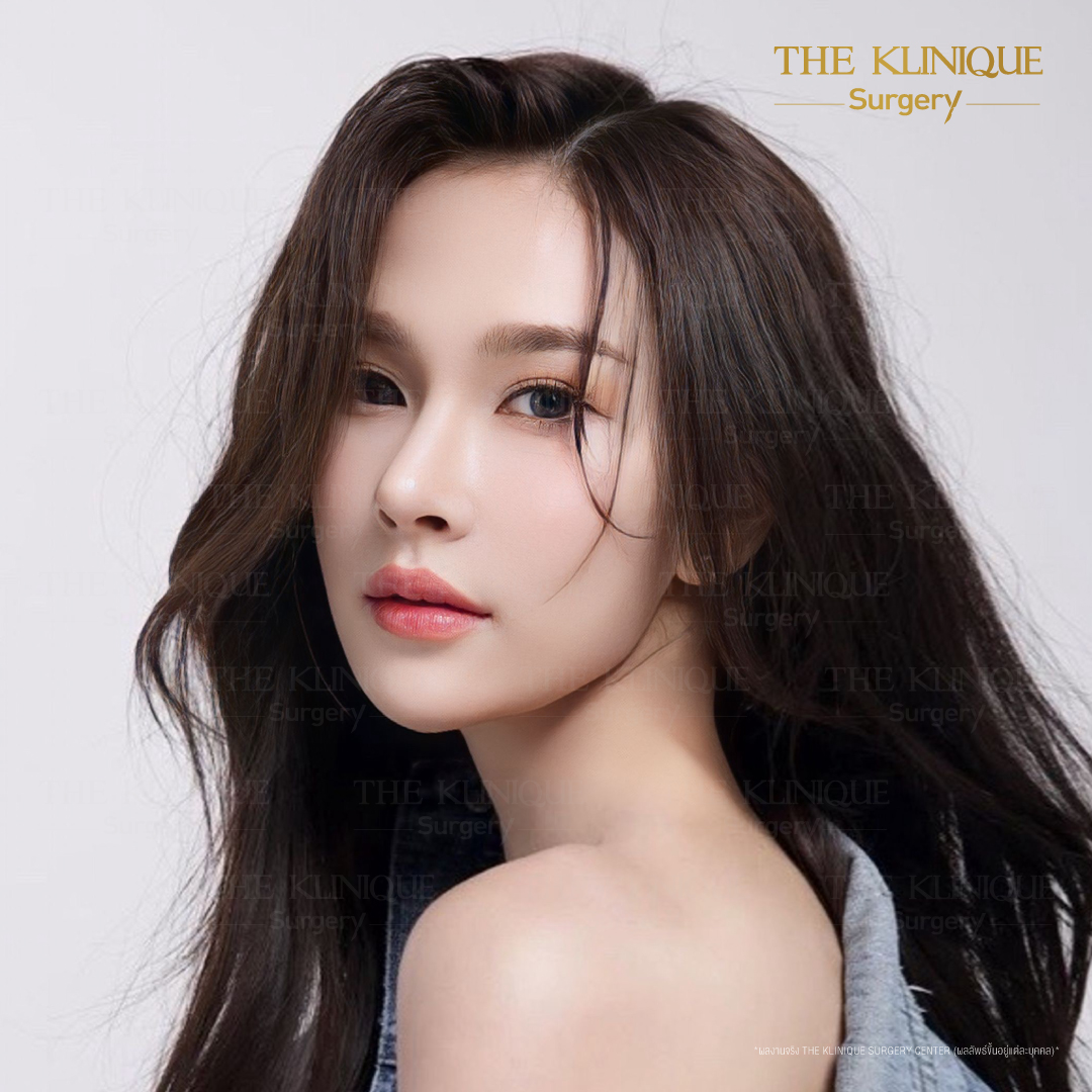 เสริมจมูก, ศัลยกรรมจมูก, ศัลยกรรมจมูก รีวิว, รีวิว เสริมจมูก, ศัลยกรรมจมูกมีกี่แบบ, เสริมจมูกที่ไหนดี, เสริมจมูกโอเพ่น, เสริมจมูกราคา, รีวิวเสริมจมูก, ทำจมูก, ทำจมูก รีวิว, รีวิวทำจมูก, รีวิว ศัลยกรรมจมูก, ซิลิโคนจมูก, แก้จมูก, แก้จมูก รีวิว, รีวิวแก้จมูก, แก้จมูกที่ไหนดี, เสริมจมูก Close, เสริมจมูก semi open, จมูก open, เสริมจมูก Open ที่ไหนดี, รีวิว เสริมจมูก Open, เสริมจมูกโอเพ่น, เสริมจมูกโอเพ่นที่ไหนดี, ทรงจมูก, ทรงจมูกสวย, ทรงจมูกเกาหลี, ทรงจมูกธรรมชาติ, ทรงจมูกสโลปปลายพุ่ง, ทรงจมูกผู้ชาย
