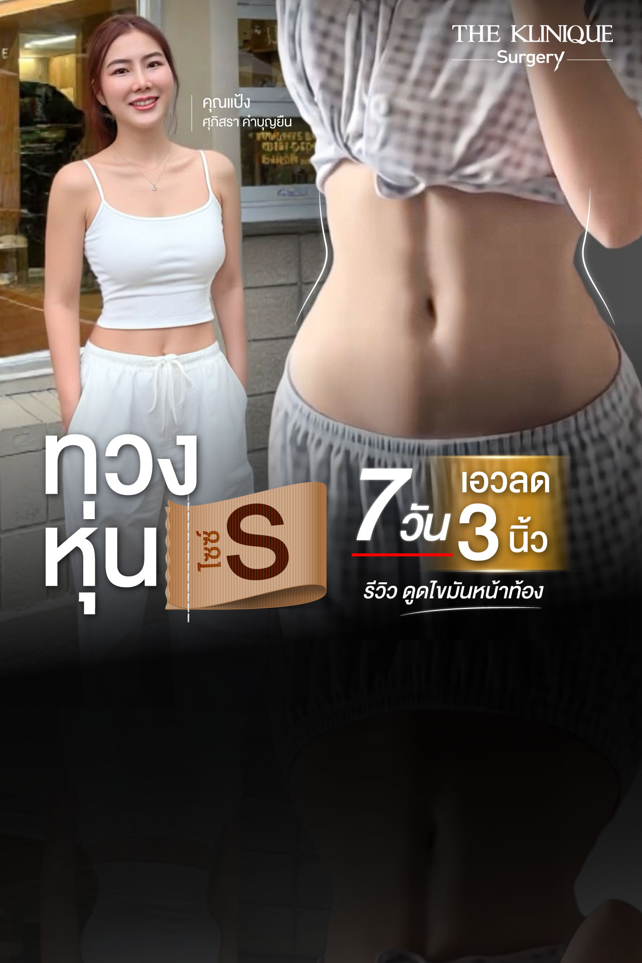 Liposuction, Sculpting,Xshape,Lipo, ศัลยกรรมดูดไขมัน, ดูดไขมัน,คลินิกดูดไขมัน,ดูดไขมันเฉพาะส่วน,ดูดไขมันเหนียง,ดูดไขมันหน้าท้อง,ดูดไขมันรีวิว, รีวิวดูดไขมัน, รีวิวดูดไขมันหน้าท้อง,ดูดไขมันต้นแขน, ดูดไขมันต้นขา,ดูดไขมันน่อง, ลดความอ้วน, ดูดไขมันที่ไหนดี, ดูดไขมันราคา, ดูดไขมันทั้งตัว, รีวิว ดูดไขมันต้นขา, ดูดไขมันขา