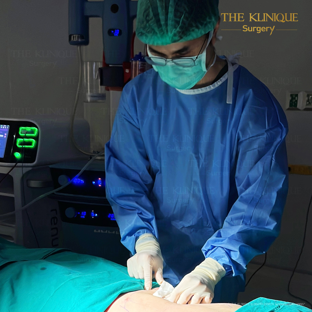 Liposuction, Sculpting,Xshape,Lipo, ศัลยกรรมดูดไขมัน, ดูดไขมัน,คลินิกดูดไขมัน,ดูดไขมันเฉพาะส่วน,ดูดไขมันเหนียง,ดูดไขมันหน้าท้อง,ดูดไขมันรีวิว, รีวิวดูดไขมัน, รีวิวดูดไขมันหน้าท้อง,ดูดไขมันต้นแขน, ดูดไขมันต้นขา,ดูดไขมันน่อง, ลดความอ้วน, ดูดไขมันที่ไหนดี, ดูดไขมันราคา, ดูดไขมันทั้งตัว, รีวิว ดูดไขมันต้นขา, ดูดไขมันขา