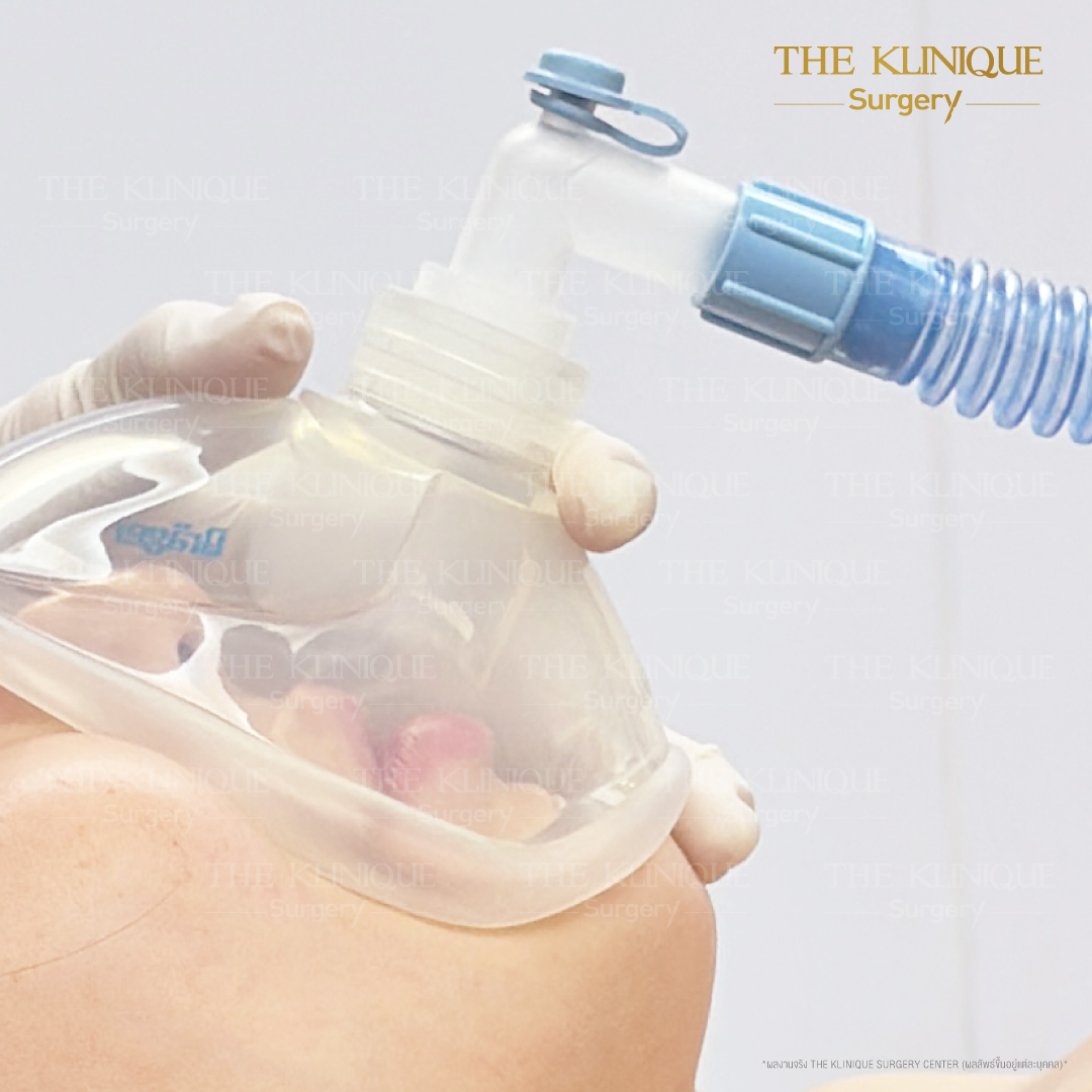 Liposuction, Sculpting,Xshape,Lipo, ศัลยกรรมดูดไขมัน, ดูดไขมัน,คลินิกดูดไขมัน,ดูดไขมันเฉพาะส่วน,ดูดไขมันเหนียง,ดูดไขมันหน้าท้อง,ดูดไขมันรีวิว, รีวิวดูดไขมัน, รีวิวดูดไขมันหน้าท้อง,ดูดไขมันต้นแขน, ดูดไขมันต้นขา,ดูดไขมันน่อง, ลดความอ้วน, ดูดไขมันที่ไหนดี, ดูดไขมันราคา, ดูดไขมันทั้งตัว, รีวิว ดูดไขมันต้นขา, ดูดไขมันขา
