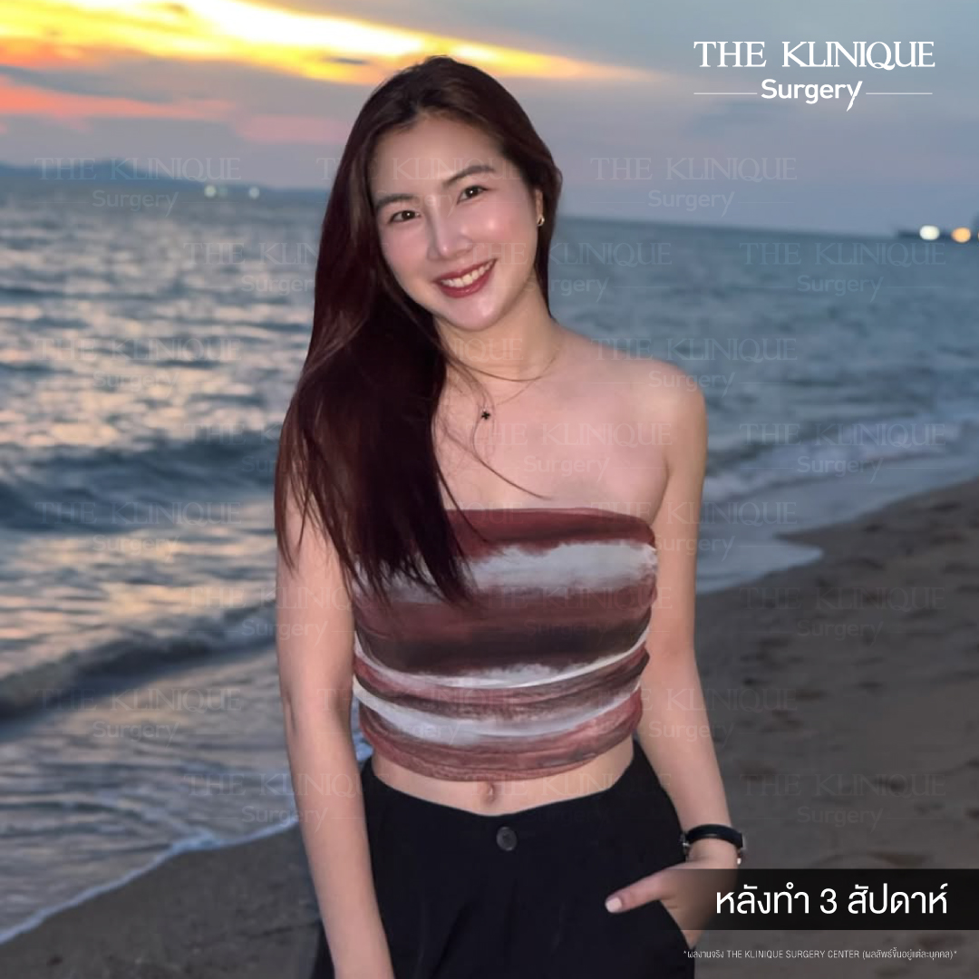 Liposuction, Sculpting,Xshape,Lipo, ศัลยกรรมดูดไขมัน, ดูดไขมัน,คลินิกดูดไขมัน,ดูดไขมันเฉพาะส่วน,ดูดไขมันเหนียง,ดูดไขมันหน้าท้อง,ดูดไขมันรีวิว, รีวิวดูดไขมัน, รีวิวดูดไขมันหน้าท้อง,ดูดไขมันต้นแขน, ดูดไขมันต้นขา,ดูดไขมันน่อง, ลดความอ้วน, ดูดไขมันที่ไหนดี, ดูดไขมันราคา, ดูดไขมันทั้งตัว, รีวิว ดูดไขมันต้นขา, ดูดไขมันขา