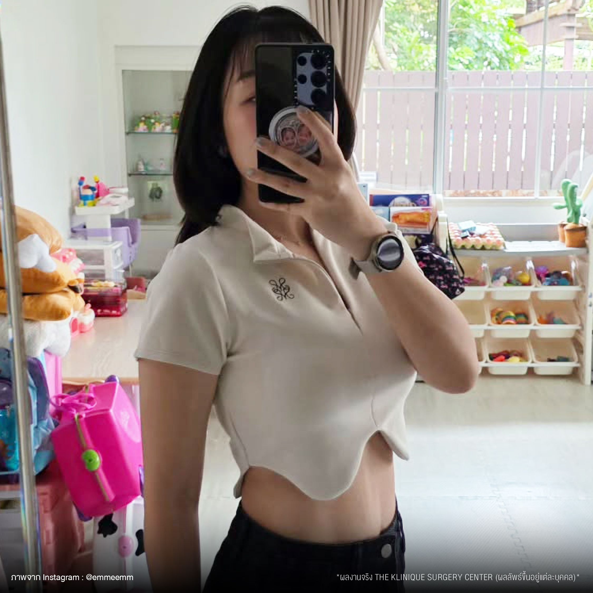 Liposuction, Sculpting,Xshape,Lipo, ศัลยกรรมดูดไขมัน, ดูดไขมัน,คลินิกดูดไขมัน,ดูดไขมันเฉพาะส่วน,ดูดไขมันเหนียง,ดูดไขมันหน้าท้อง,ดูดไขมันรีวิว, รีวิวดูดไขมัน, รีวิวดูดไขมันหน้าท้อง,ดูดไขมันต้นแขน, ดูดไขมันต้นขา,ดูดไขมันน่อง, ลดความอ้วน, ดูดไขมันที่ไหนดี, ดูดไขมันราคา, ดูดไขมันทั้งตัว, รีวิว ดูดไขมันต้นขา, ดูดไขมันขา