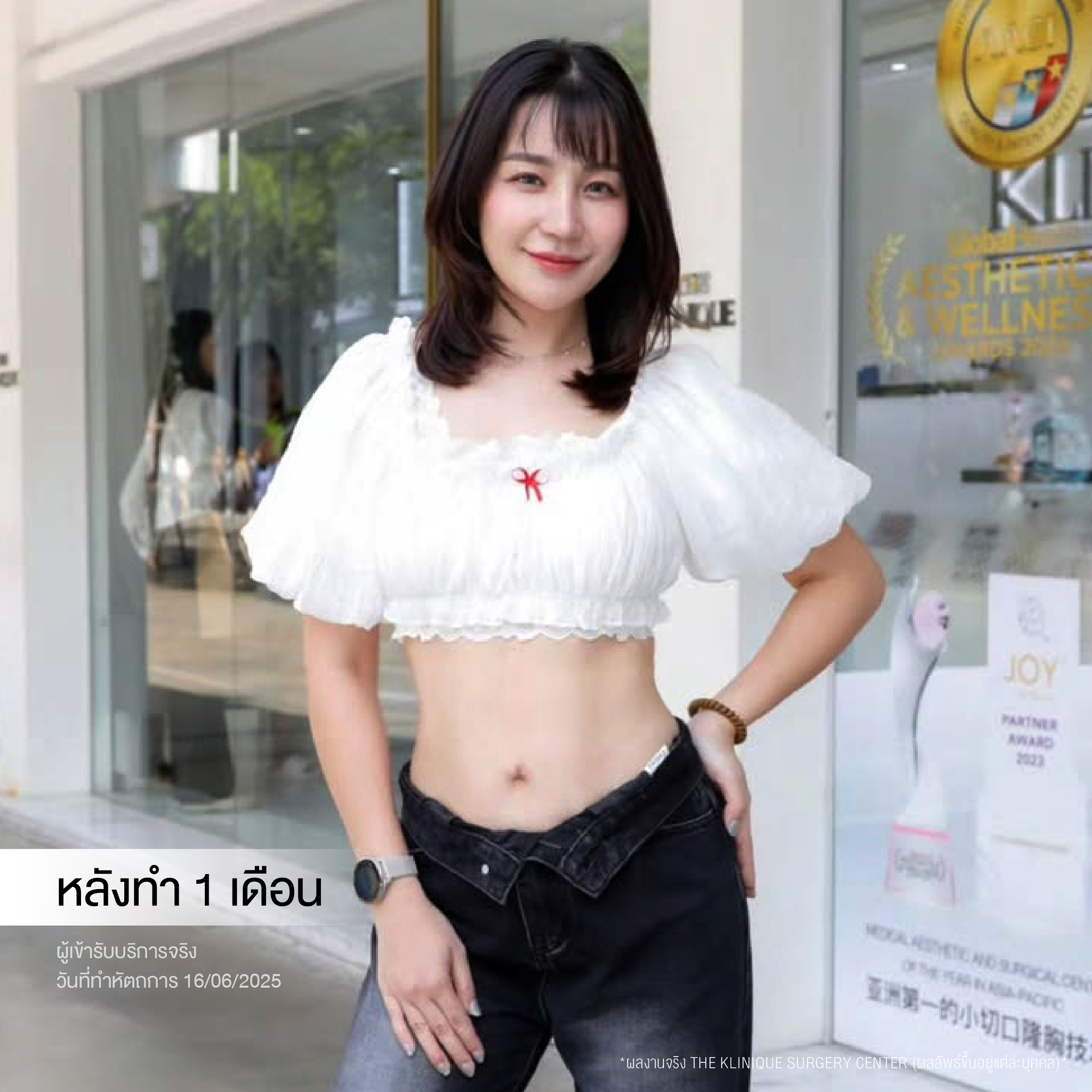 Liposuction, Sculpting,Xshape,Lipo, ศัลยกรรมดูดไขมัน, ดูดไขมัน,คลินิกดูดไขมัน,ดูดไขมันเฉพาะส่วน,ดูดไขมันเหนียง,ดูดไขมันหน้าท้อง,ดูดไขมันรีวิว, รีวิวดูดไขมัน, รีวิวดูดไขมันหน้าท้อง,ดูดไขมันต้นแขน, ดูดไขมันต้นขา,ดูดไขมันน่อง, ลดความอ้วน, ดูดไขมันที่ไหนดี, ดูดไขมันราคา, ดูดไขมันทั้งตัว, รีวิว ดูดไขมันต้นขา, ดูดไขมันขา