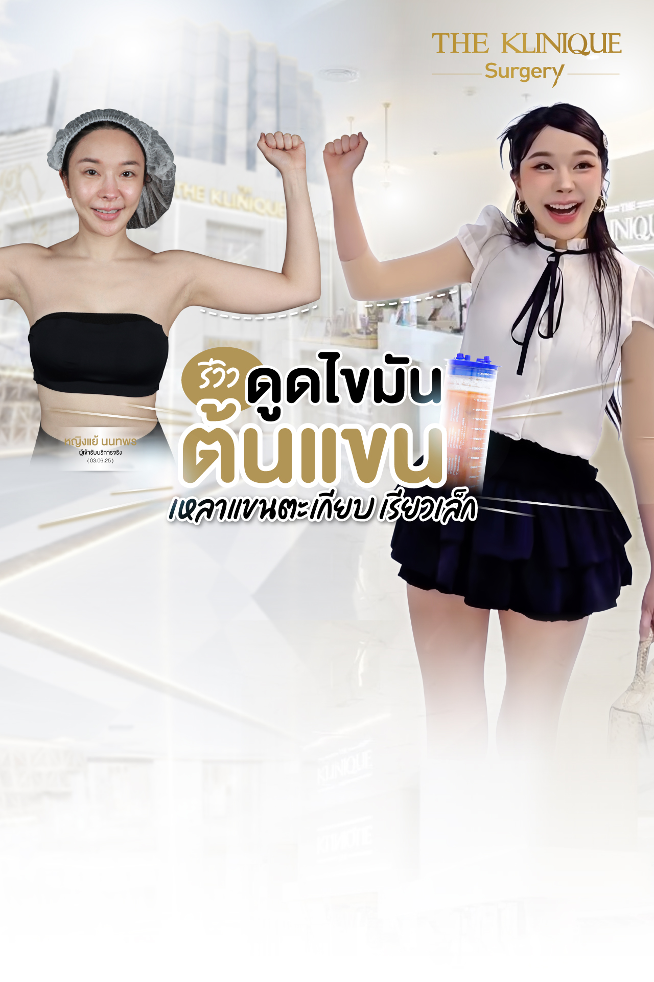Liposuction, Sculpting,Xshape,Lipo, ศัลยกรรมดูดไขมัน, ดูดไขมัน,คลินิกดูดไขมัน,ดูดไขมันเฉพาะส่วน,ดูดไขมันเหนียง,ดูดไขมันหน้าท้อง,ดูดไขมันรีวิว, รีวิวดูดไขมัน, รีวิวดูดไขมันหน้าท้อง,ดูดไขมันต้นแขน, ดูดไขมันต้นขา,ดูดไขมันน่อง, ลดความอ้วน, ดูดไขมันที่ไหนดี, ดูดไขมันราคา, ดูดไขมันทั้งตัว, รีวิว ดูดไขมันต้นขา, ดูดไขมันขา